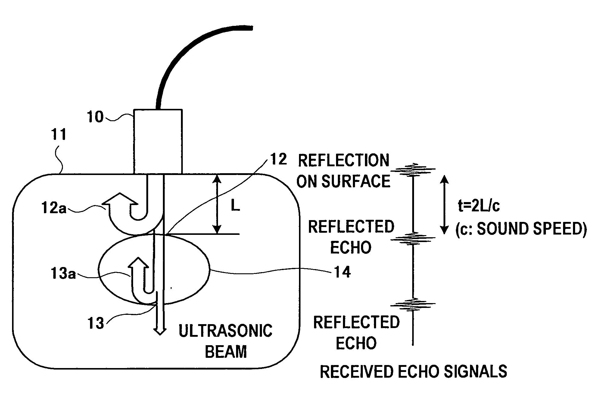 Ultrasonic diagnosis system and strain distribution display method