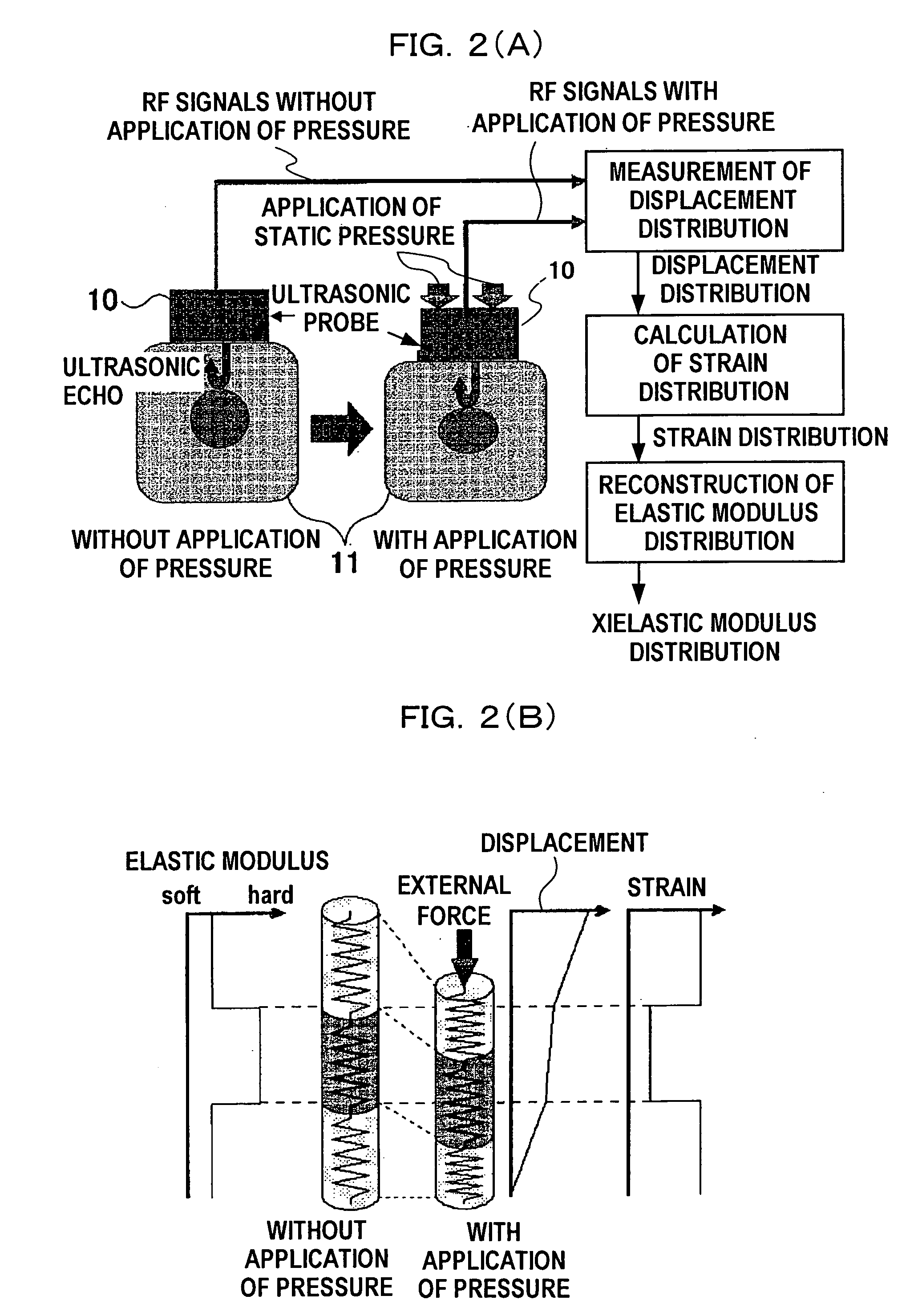 Ultrasonic diagnosis system and strain distribution display method