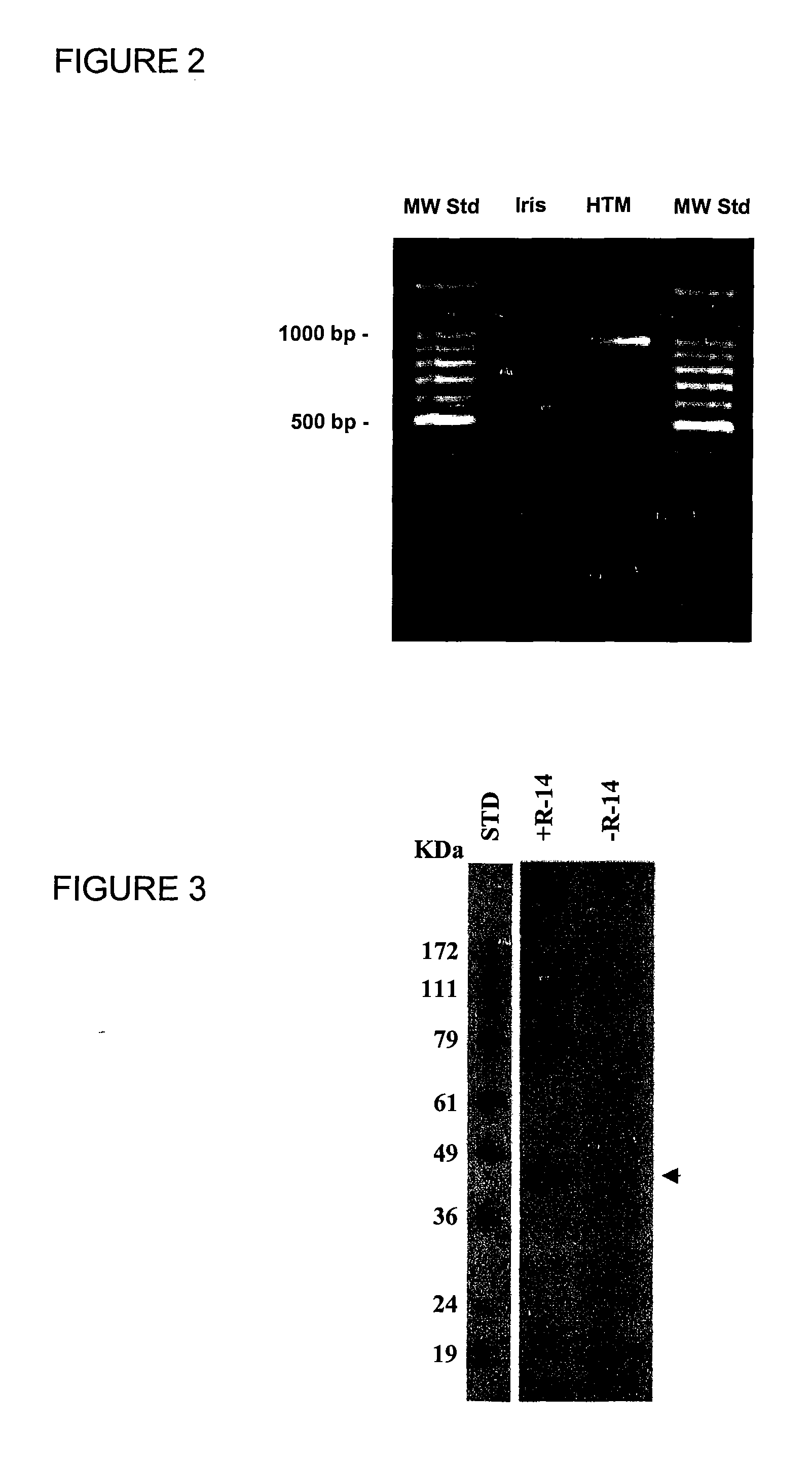 Methods and compounds for prevention and treatment of elevated intraocular pressure and related conditions