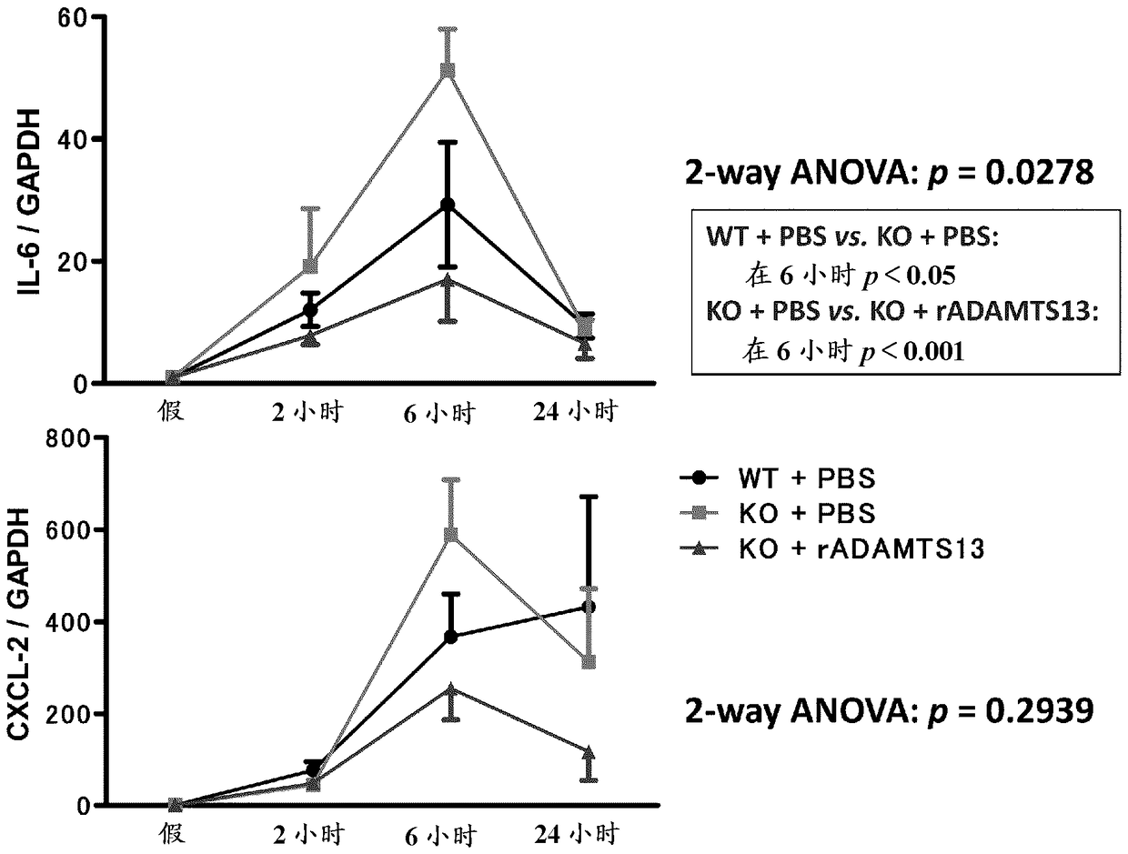 Diagnostic agent and medicine comprising adamts13 as main ingredient