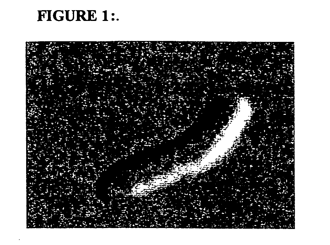 Methods and compositions for the treatment of diseases characterized by pathological calcification