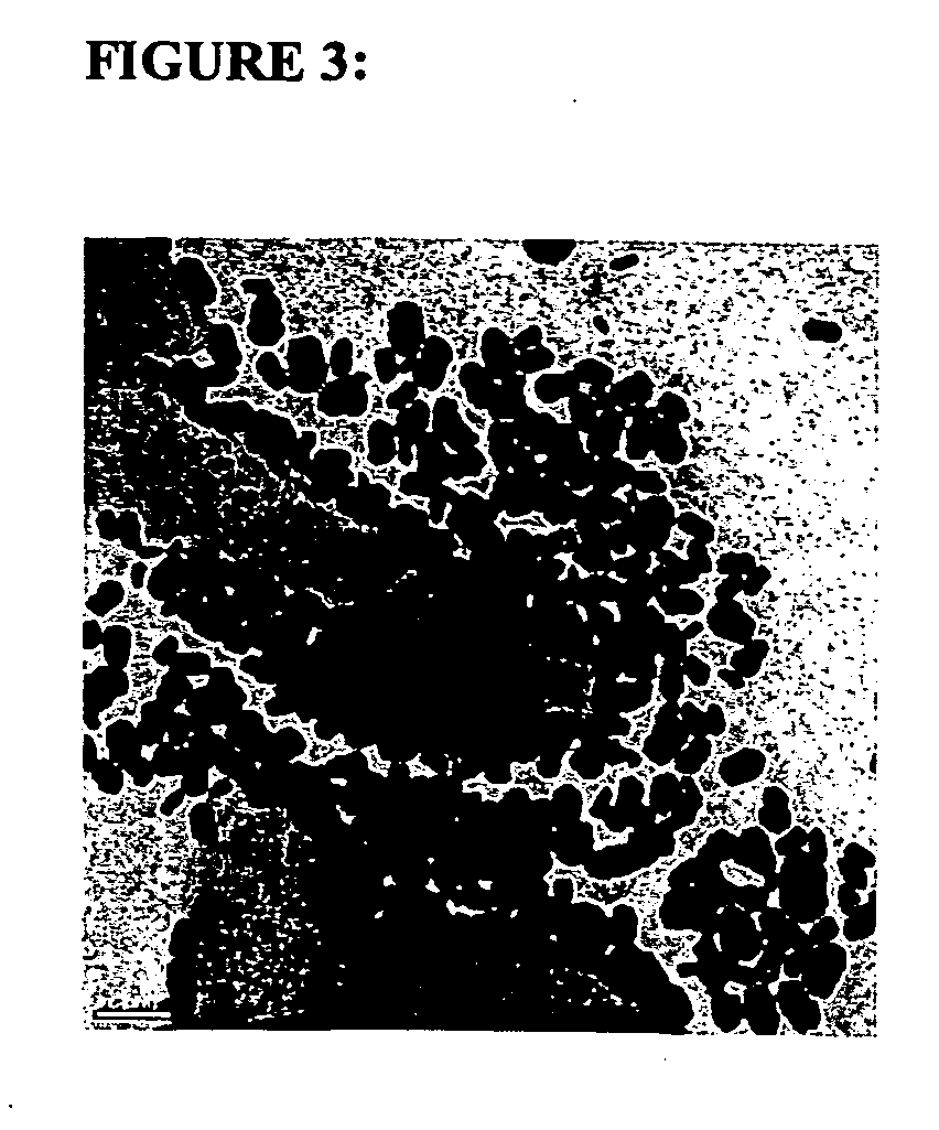 Methods and compositions for the treatment of diseases characterized by pathological calcification