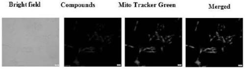 Preparation method and application of tumor-targeted diagnosis and treatment combined single-molecule lead compound