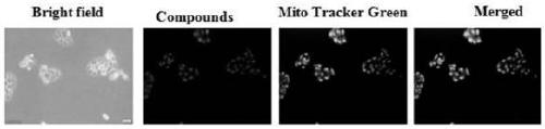 Preparation method and application of tumor-targeted diagnosis and treatment combined single-molecule lead compound