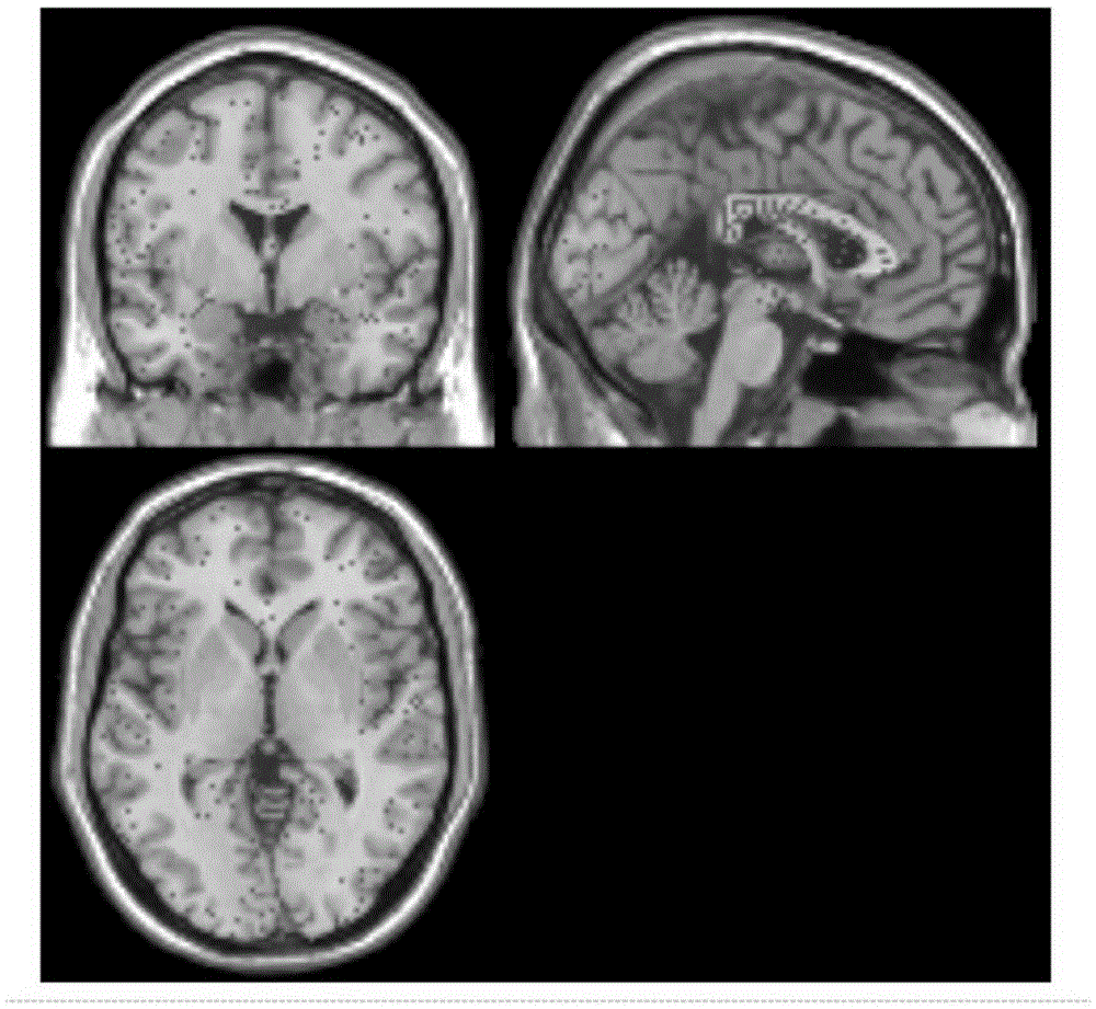 Electroencephalogram (EEG) channel selection method assisted by functional magnetic resonance imaging