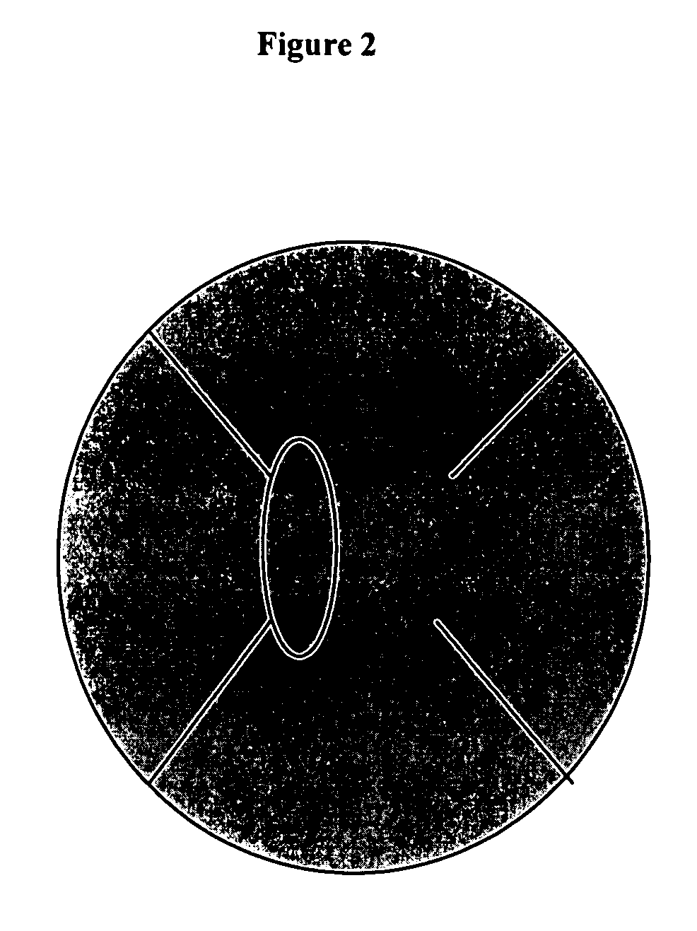 Compositions and methods for treating eye disorders and conditions