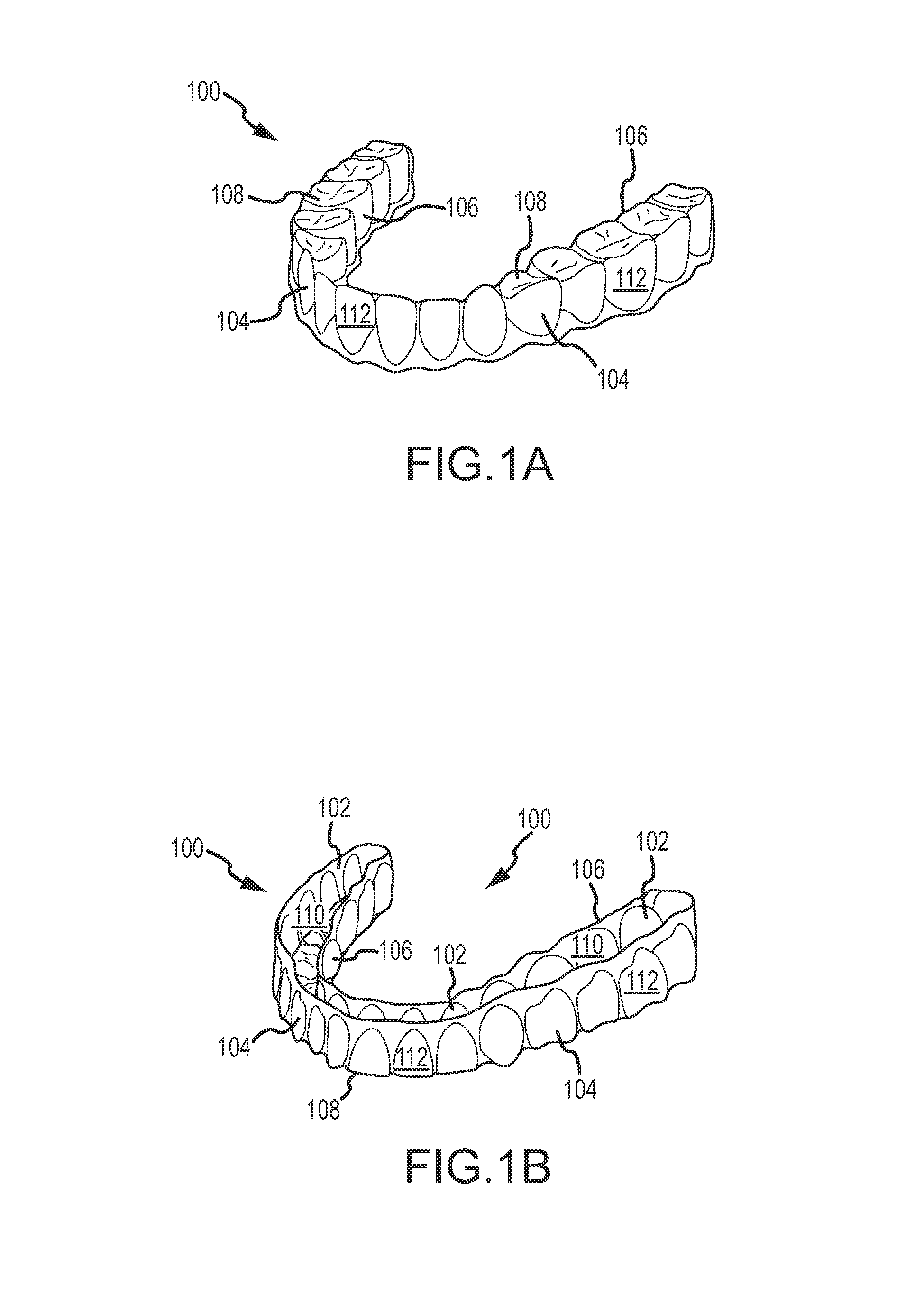 Dental appliance, dental appliance adhesive and related methods and uses