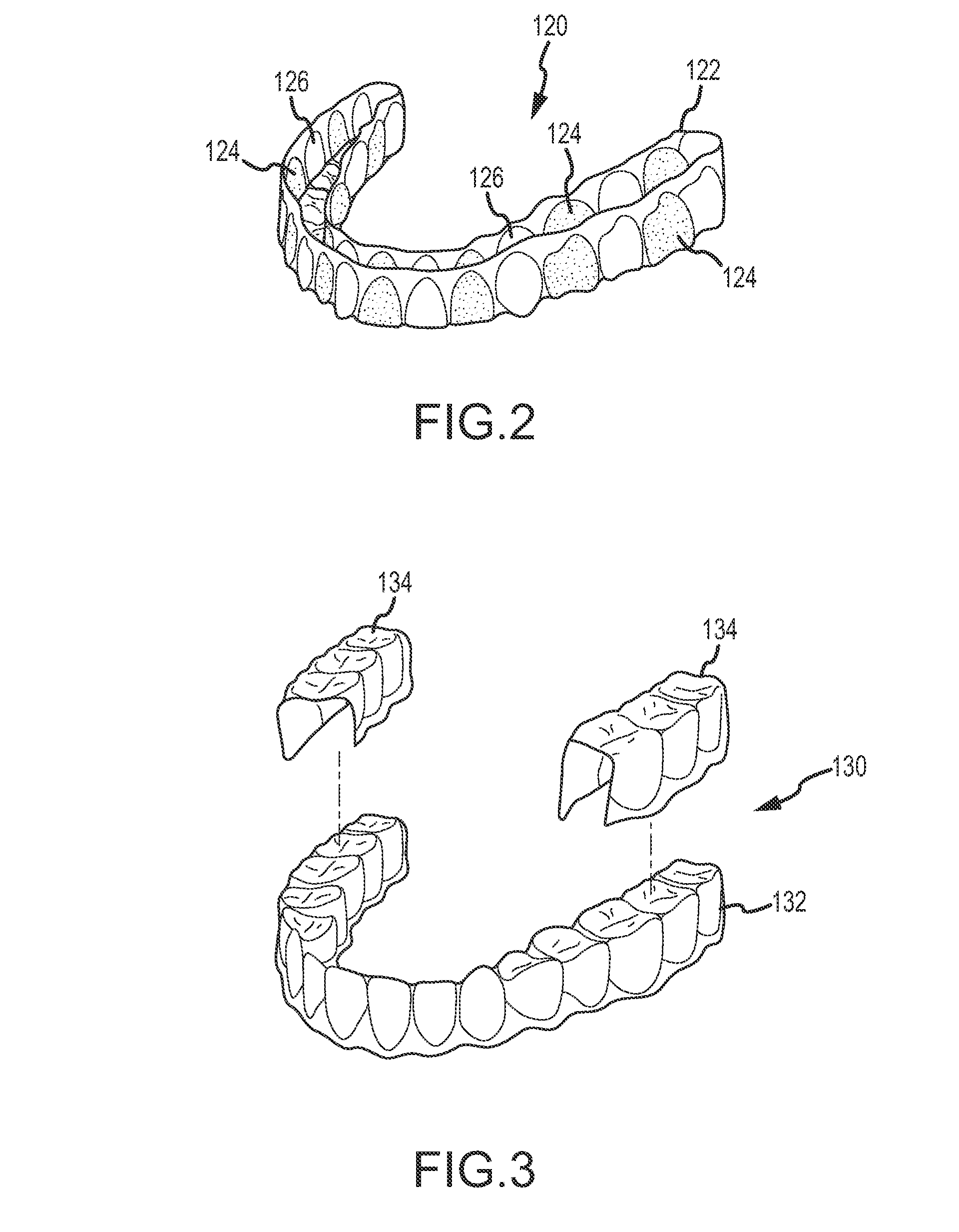 Dental appliance, dental appliance adhesive and related methods and uses