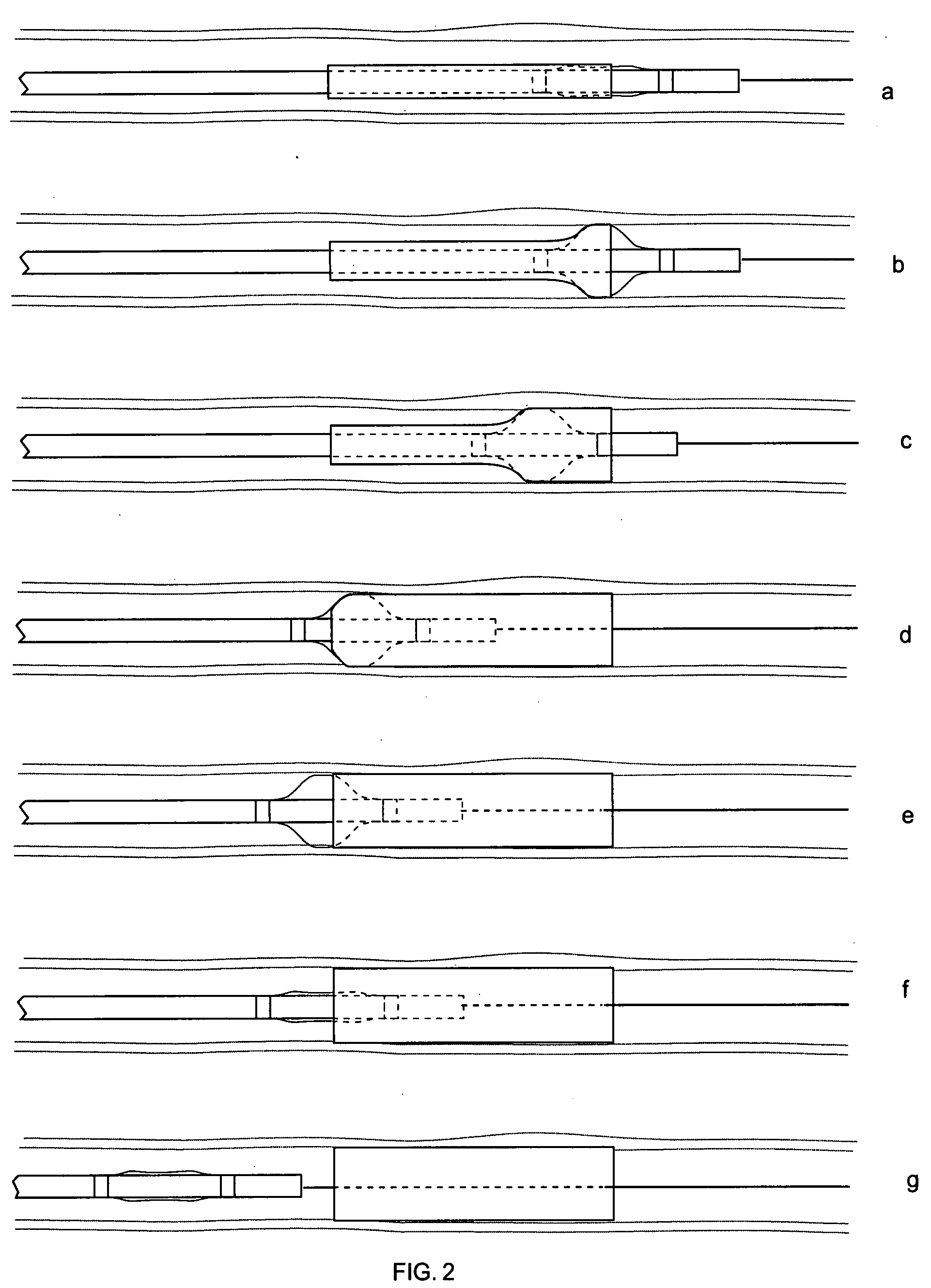 Conformable vascular prosthesis delivery system