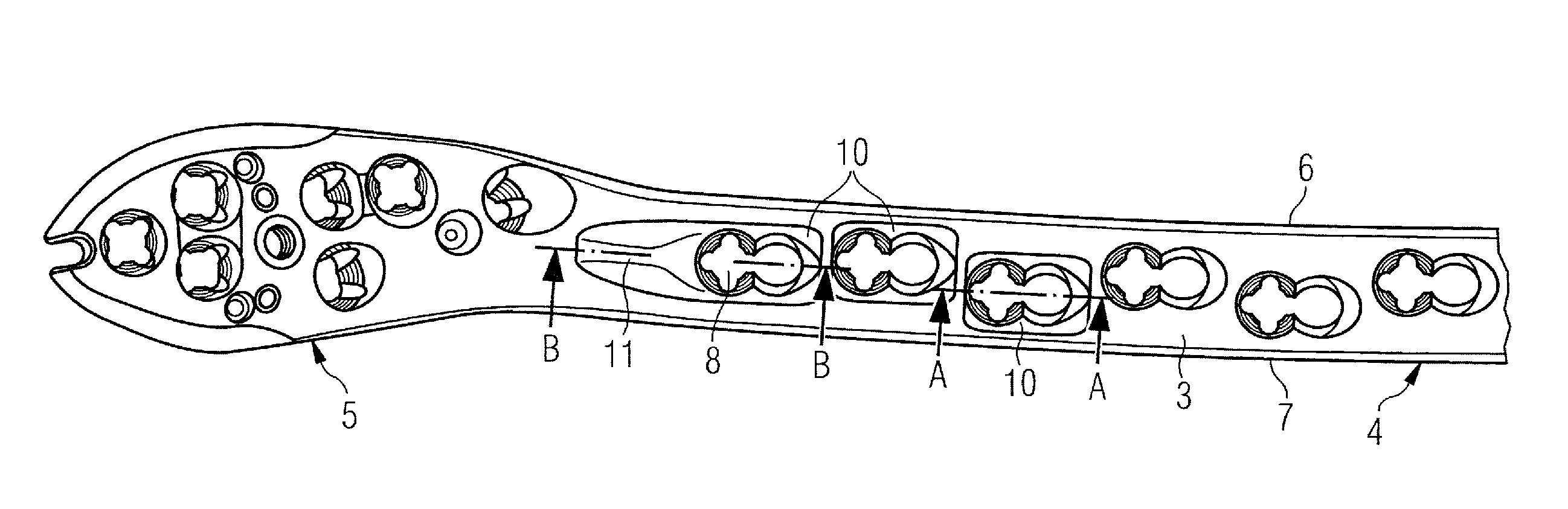 Bone plate