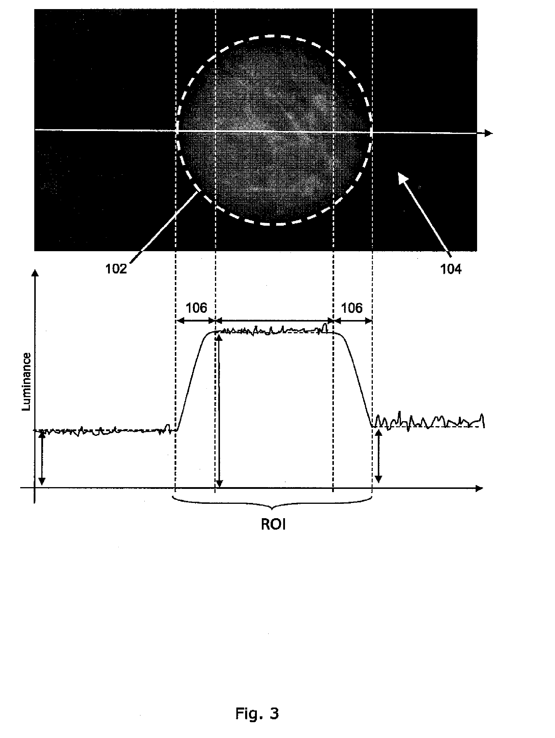 Method and system for improving the visibility of features of an image