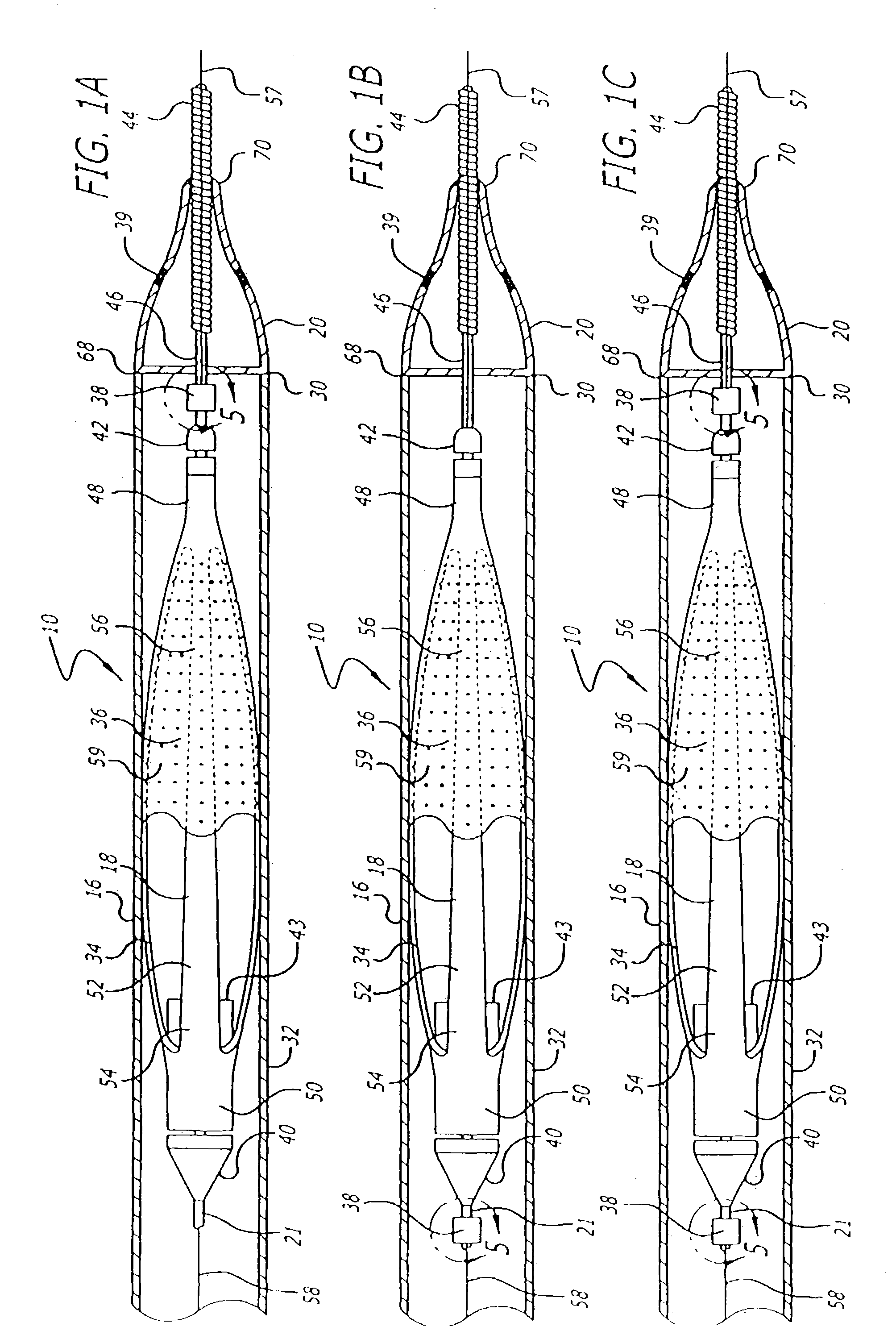 Hinged short cage for an embolic protection device