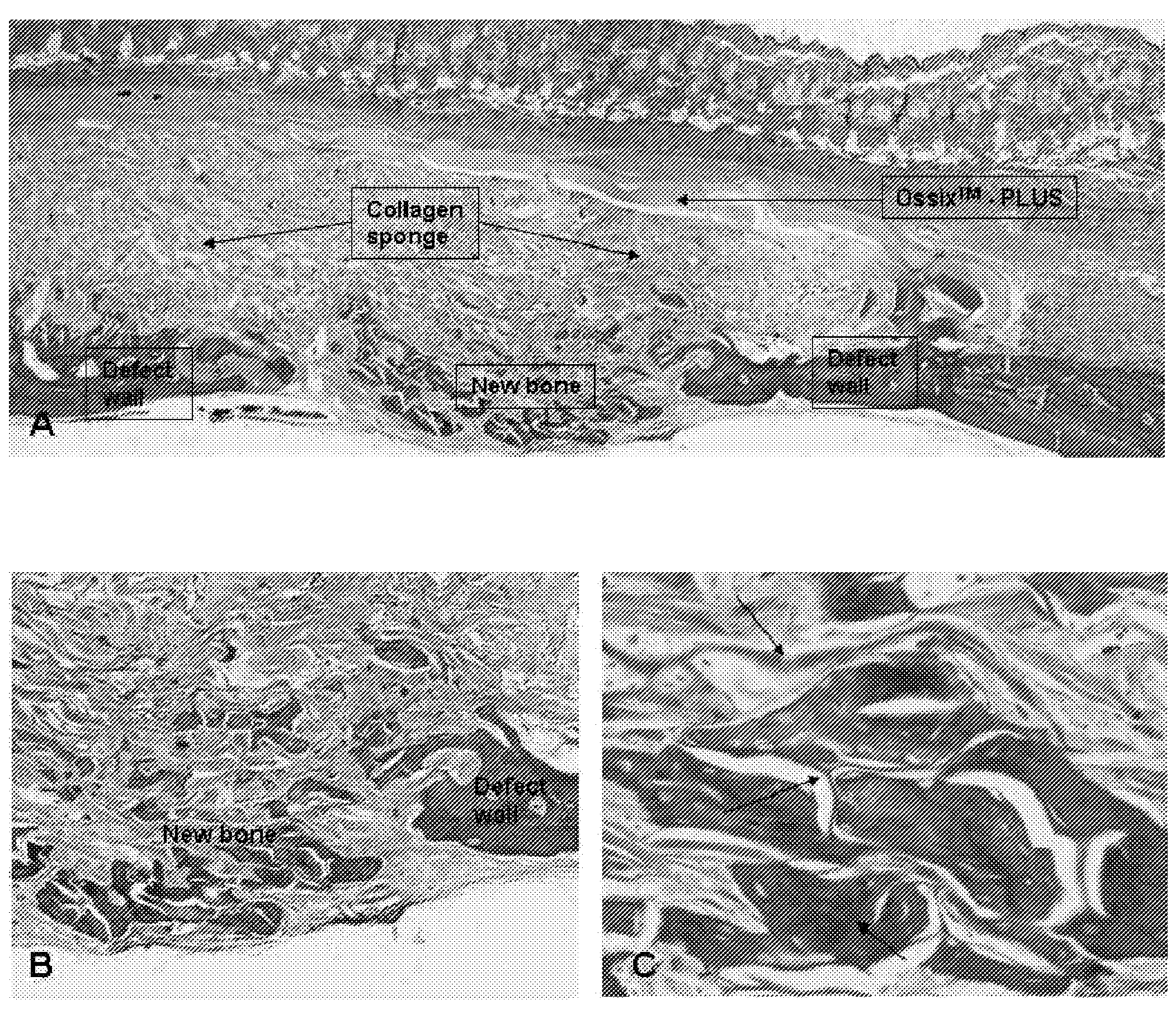 Composite implants for promoting bone regeneration and augmentation and methods for their preparation and use