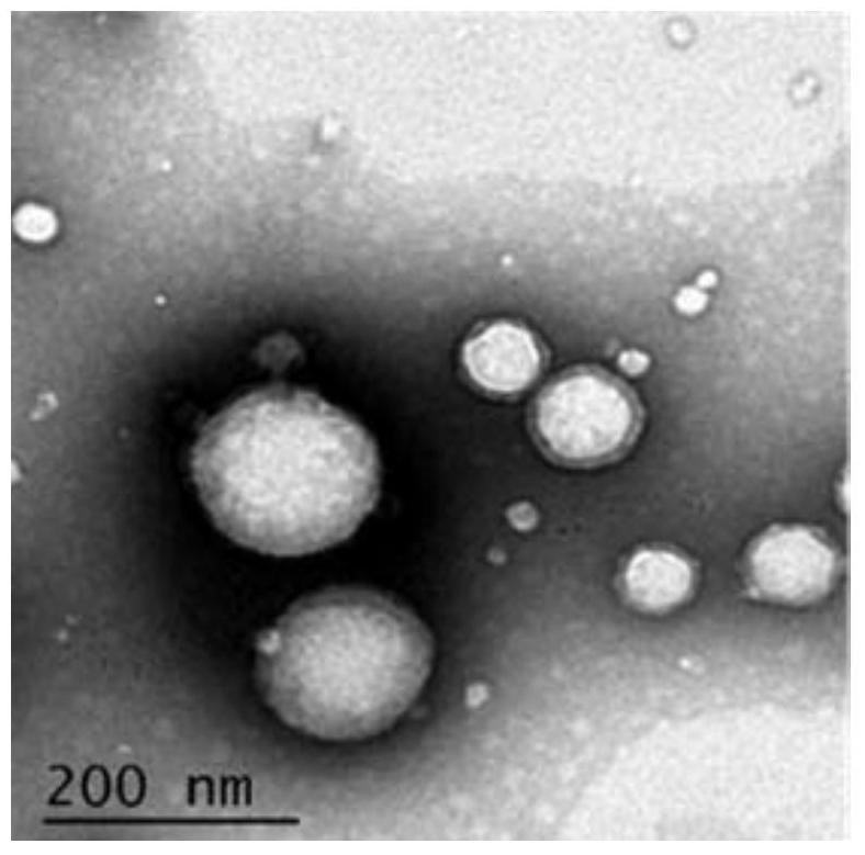 An active targeting ultrasound/fluorescence dual-mode contrast agent and its preparation method and application