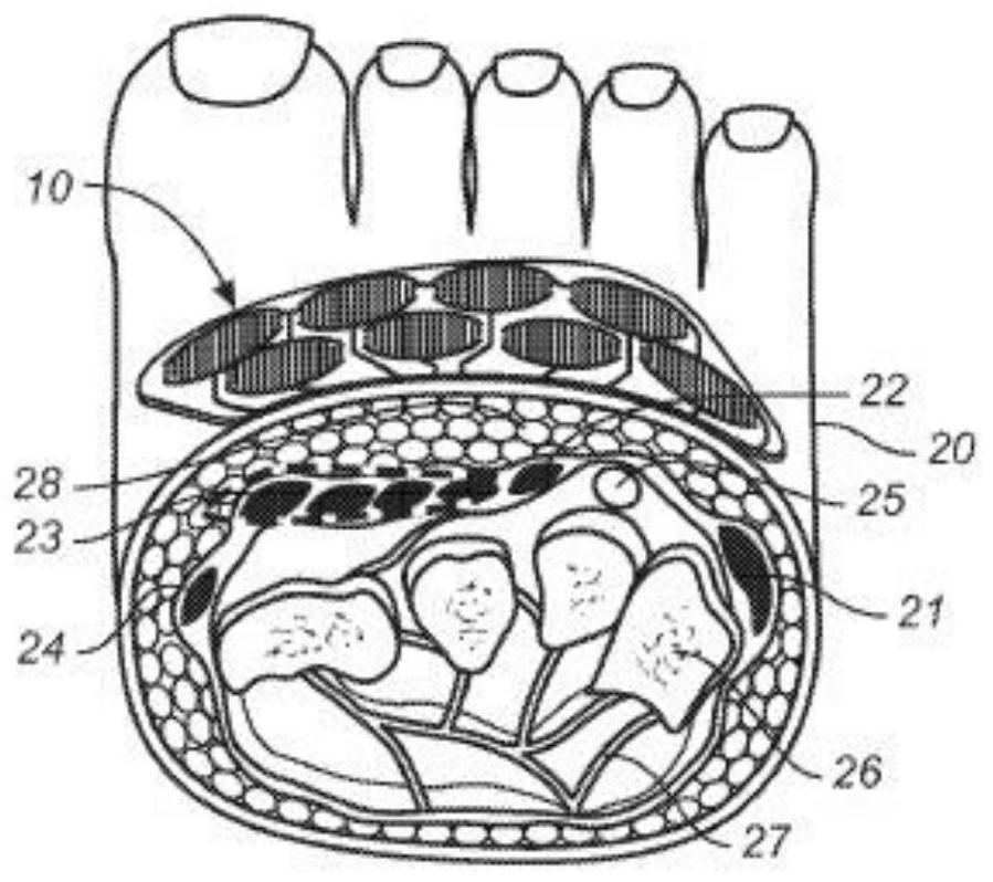 Wearable footwear sensor arrays for detection of cardiac events, body motion, and muscular actions