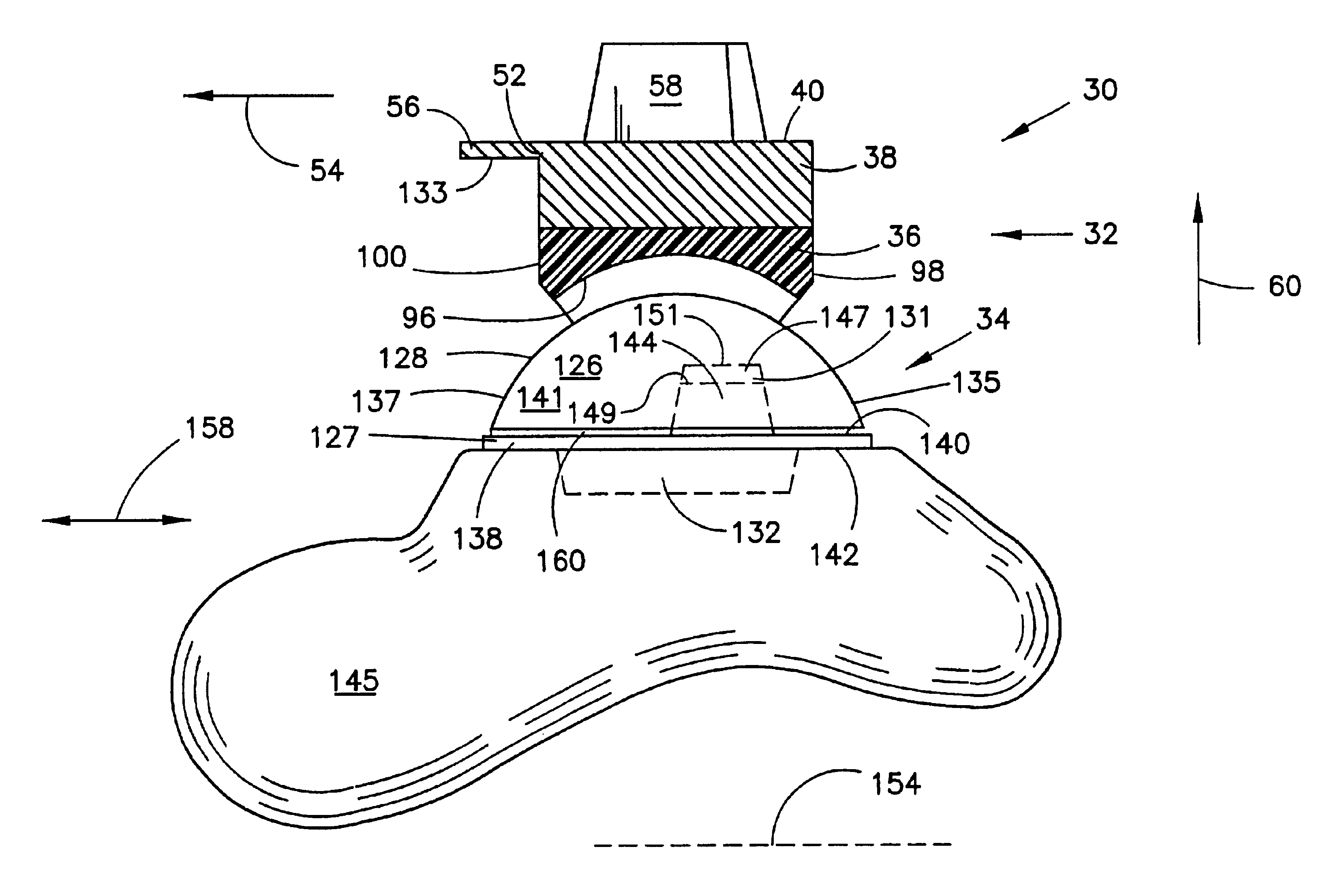 Mobile talar component for total ankle replacement implant