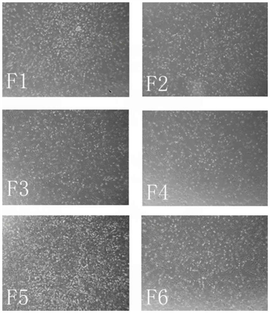 A kind of culture method of pig dermal papilla cell