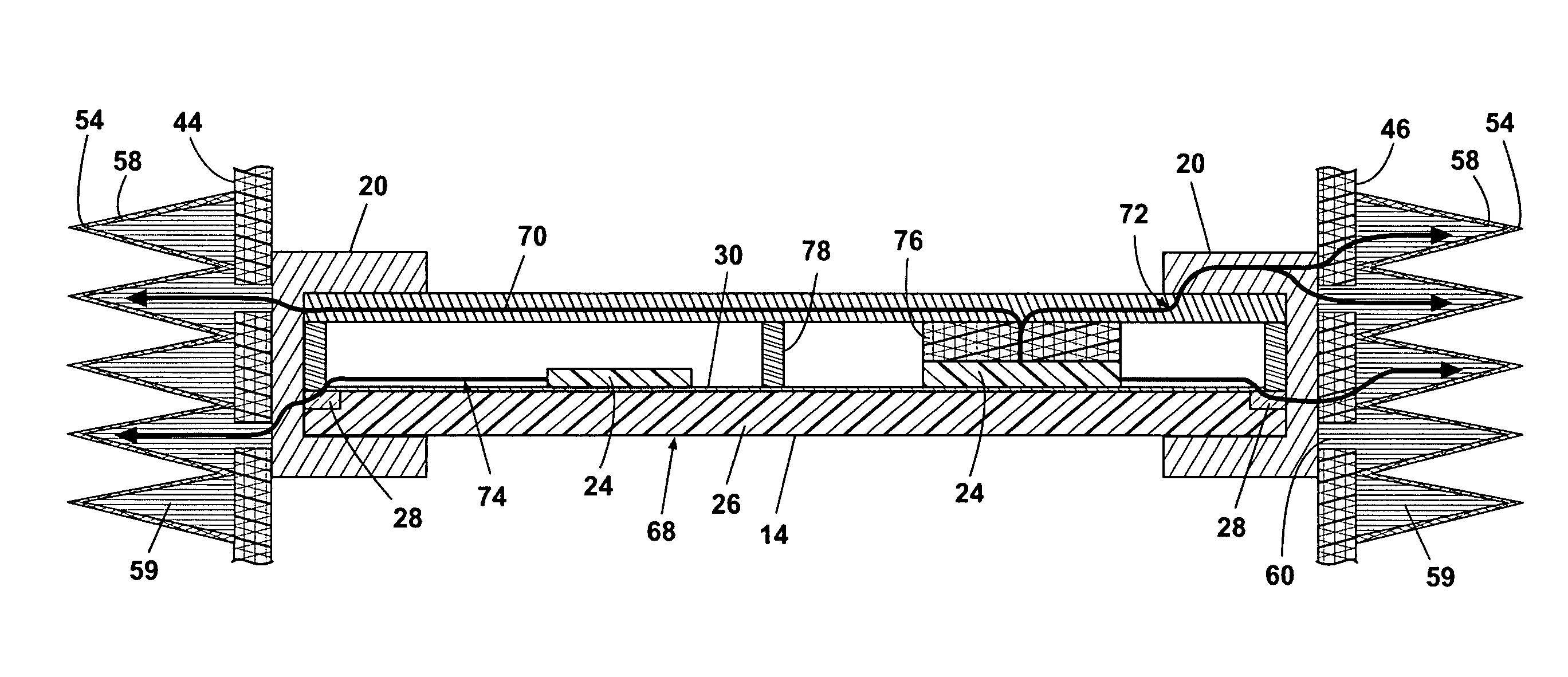 Avionics chassis