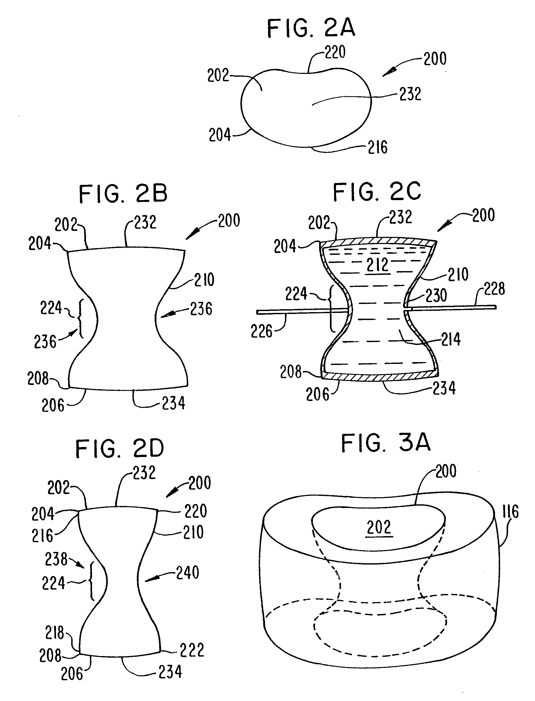 Intervertebral disc and nucleus prosthesis