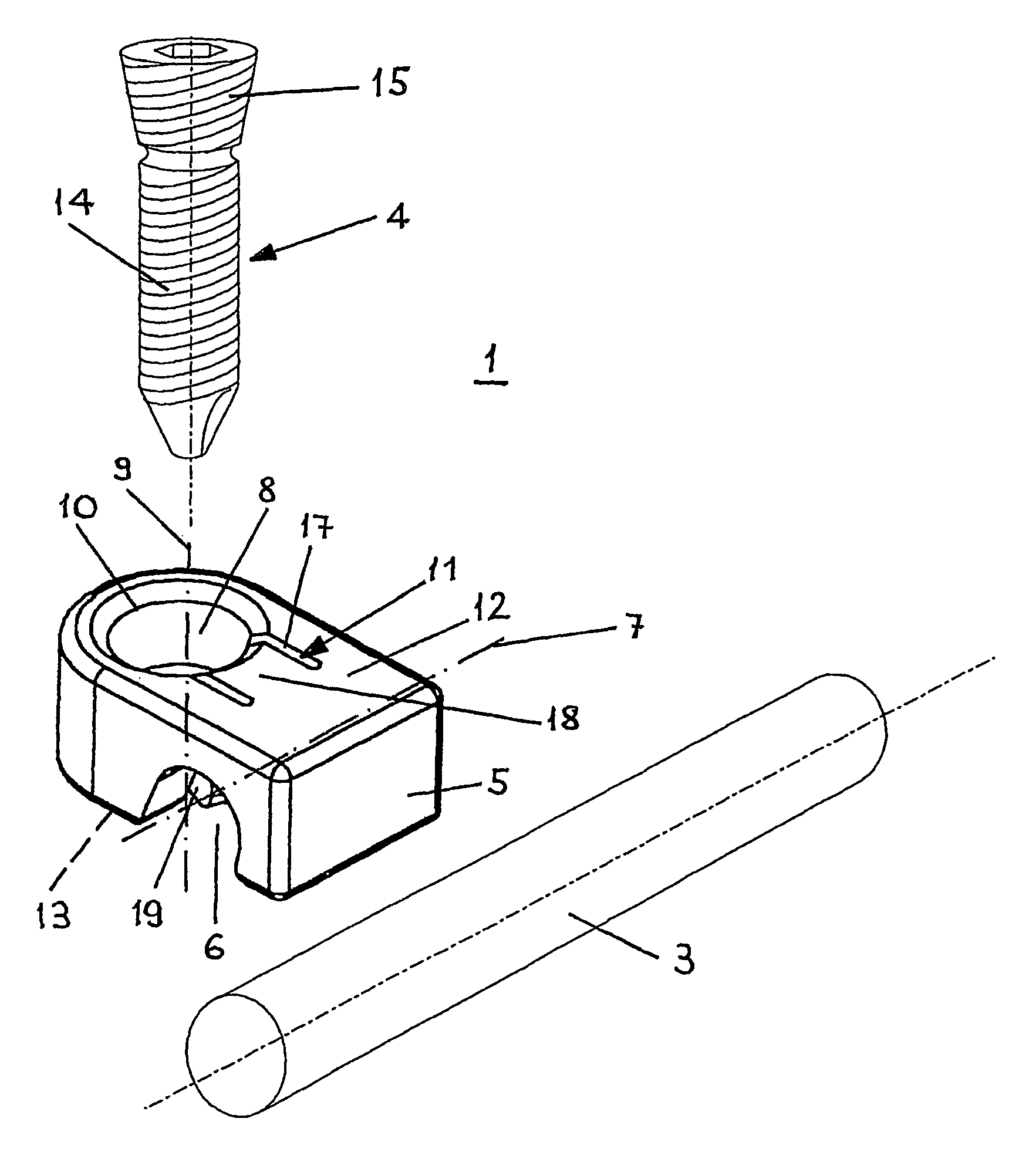 Angularly stable device for mutually fixing a longitudinal carrier with a bone fixation element