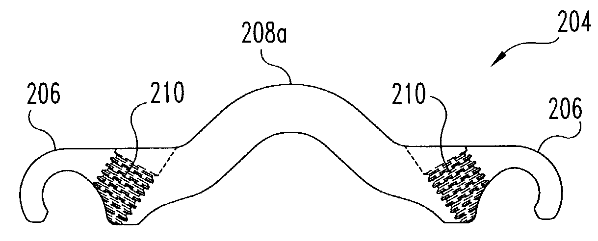 Posterior fixation system