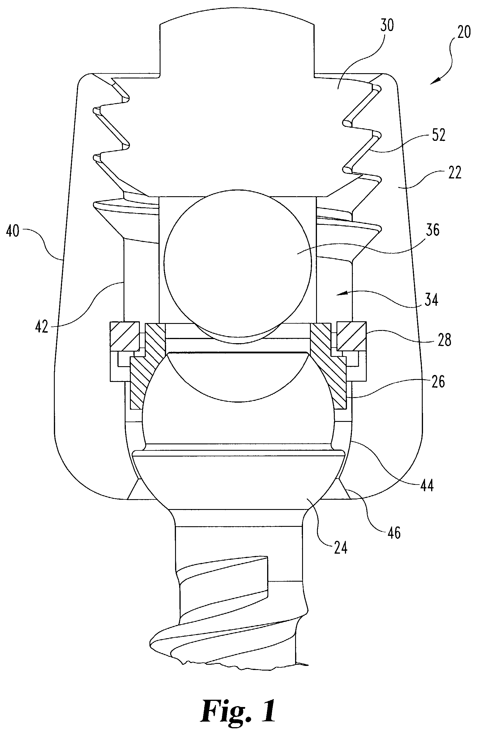 Posterior fixation system