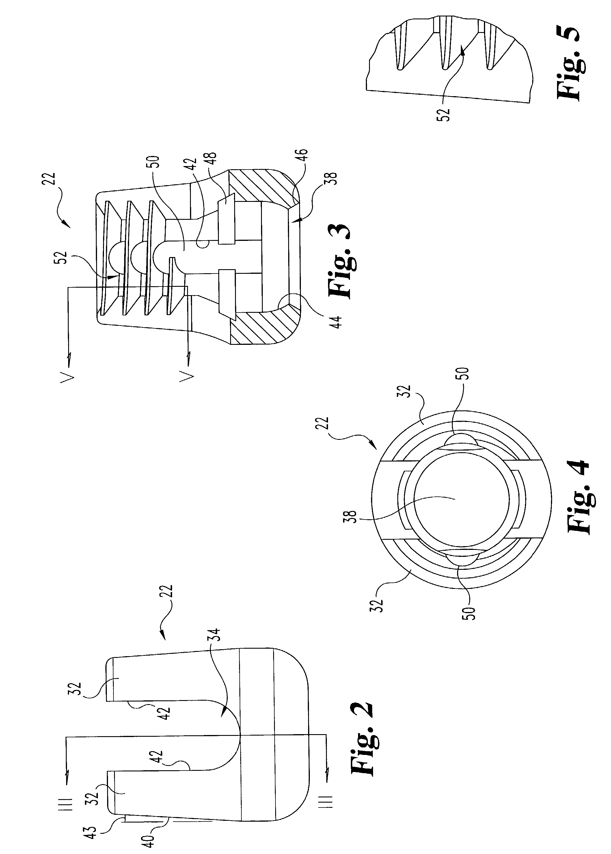 Posterior fixation system