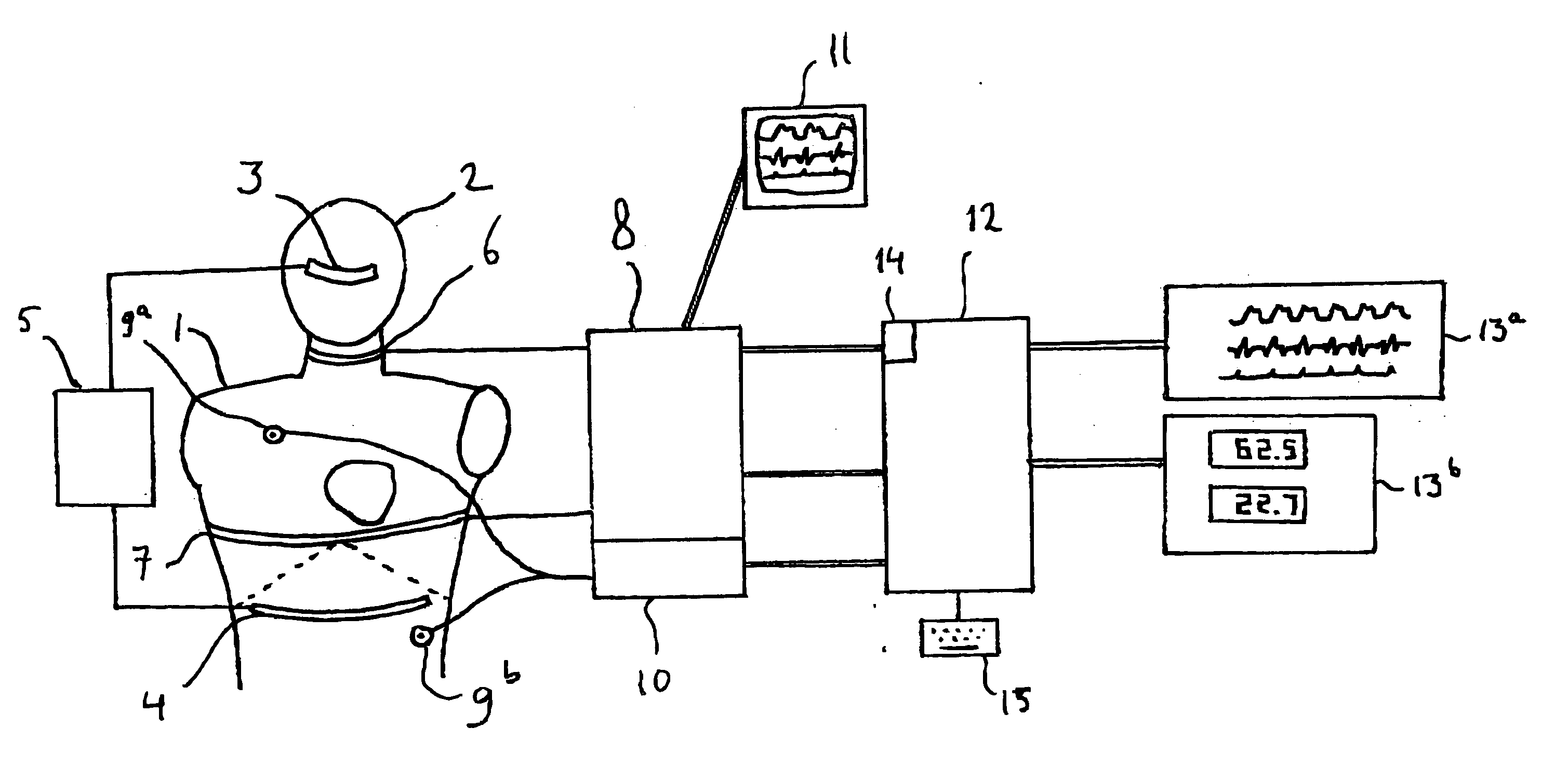 Device and method for determining coronary blood flow