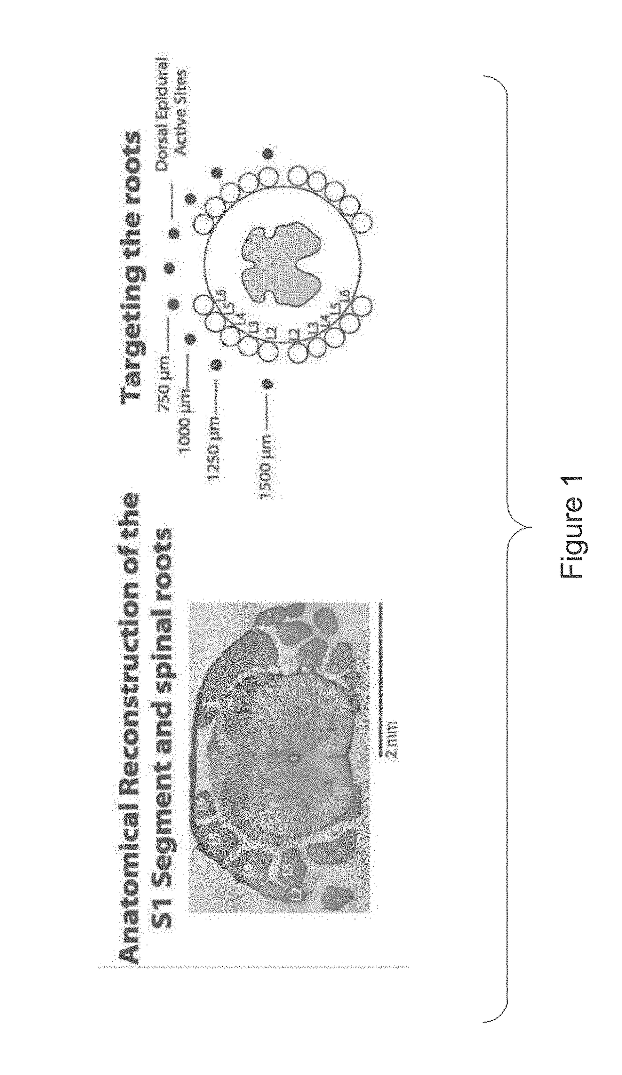 System for selective spatiotemporal stimulation of the spinal cord