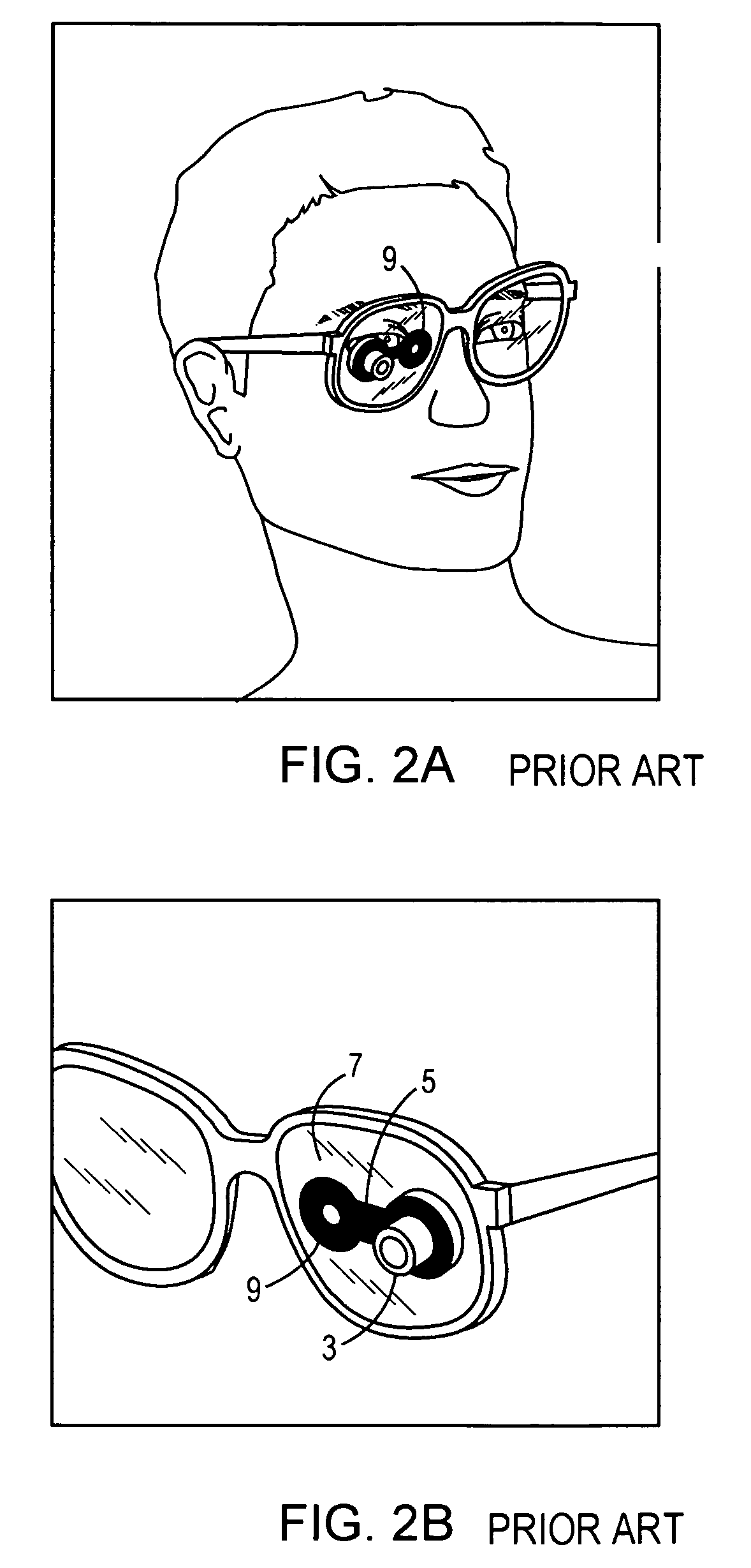 Vision enhancement apparatus to improve both near and far vision