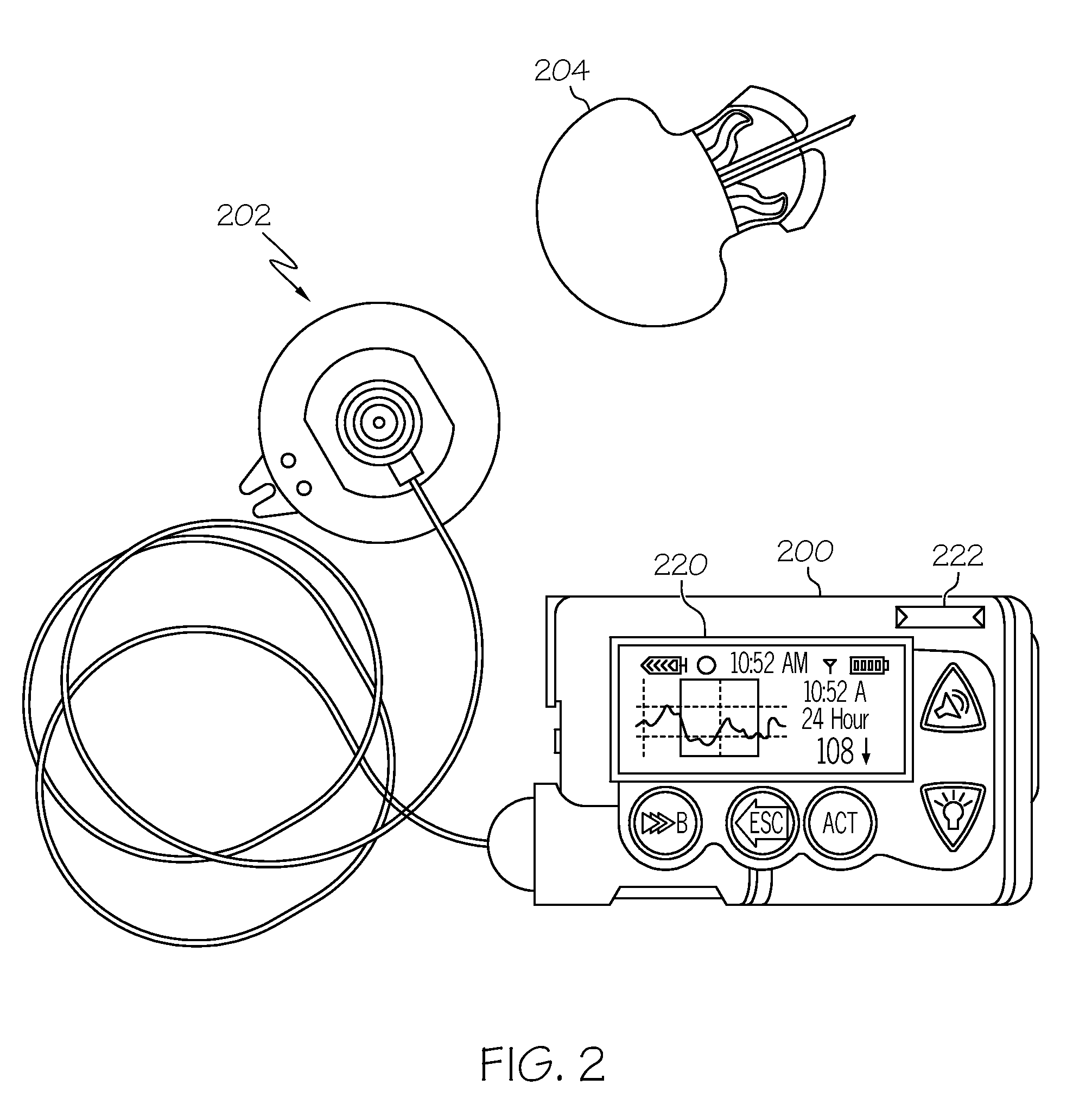 Coordination of control commands in a medical device system having at least one therapy delivery device and at least one wireless controller device