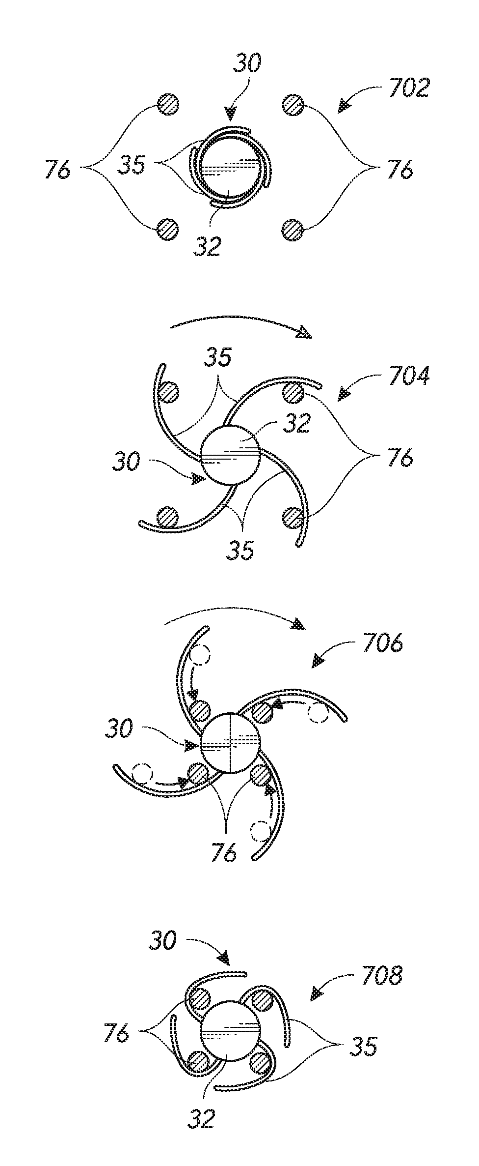 Chordae tendineae adjustment