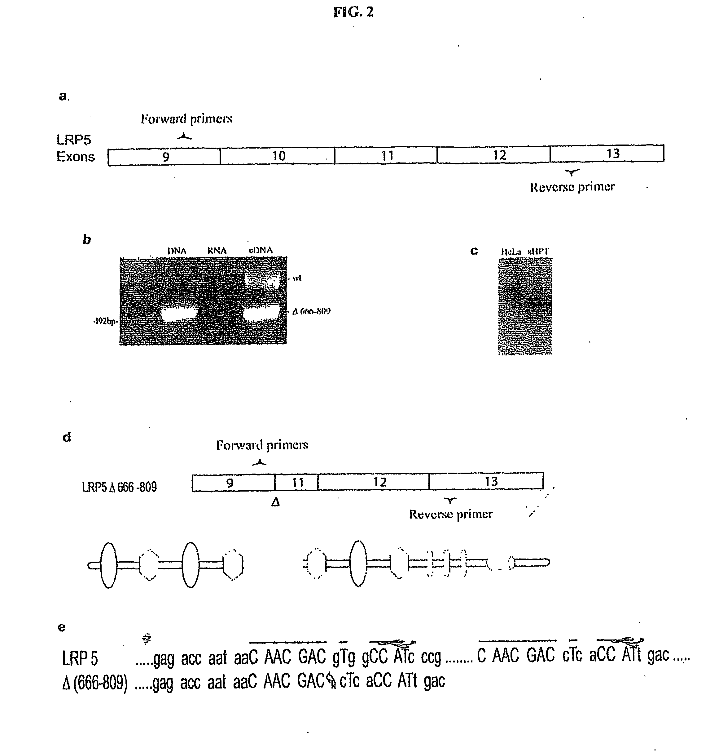 Mutant Lrp5/6 Wnt-Signaling Receptors in Cancer Diagnosis, Prognosis, and Treatment