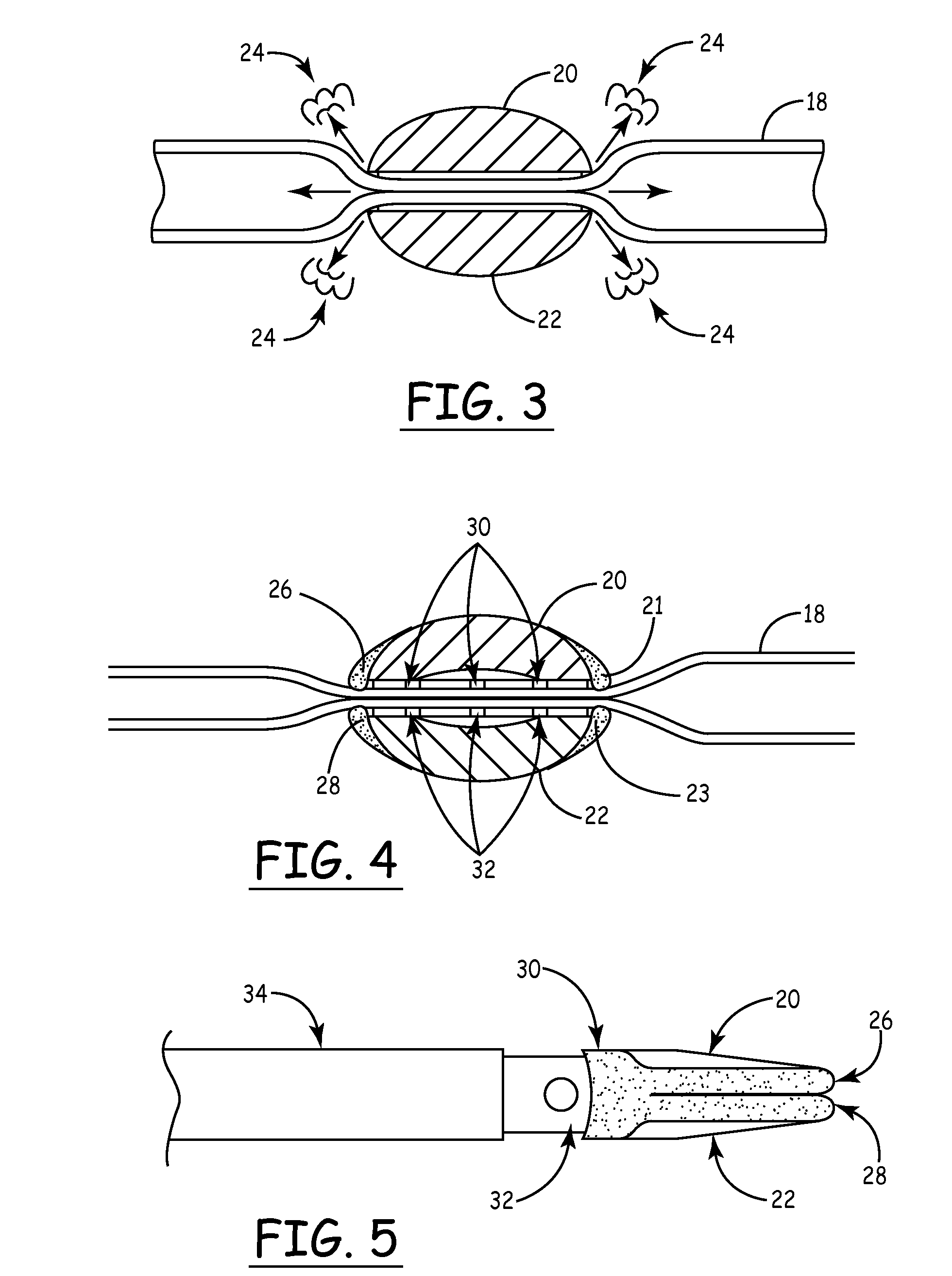 Tissue sealing method