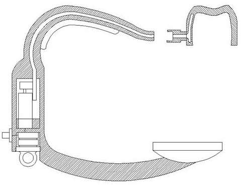 An orthodontic accelerator