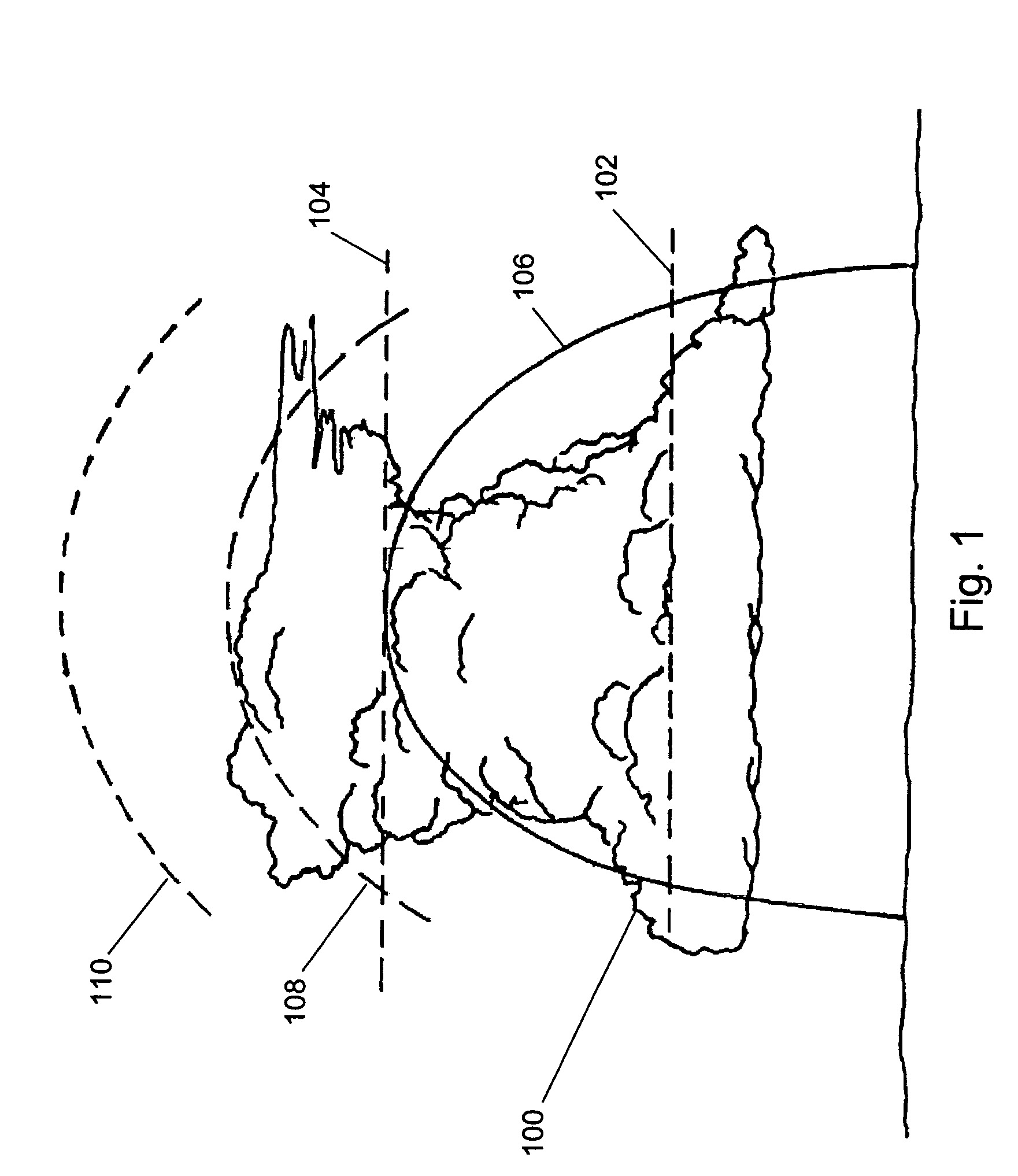 Storm top detection