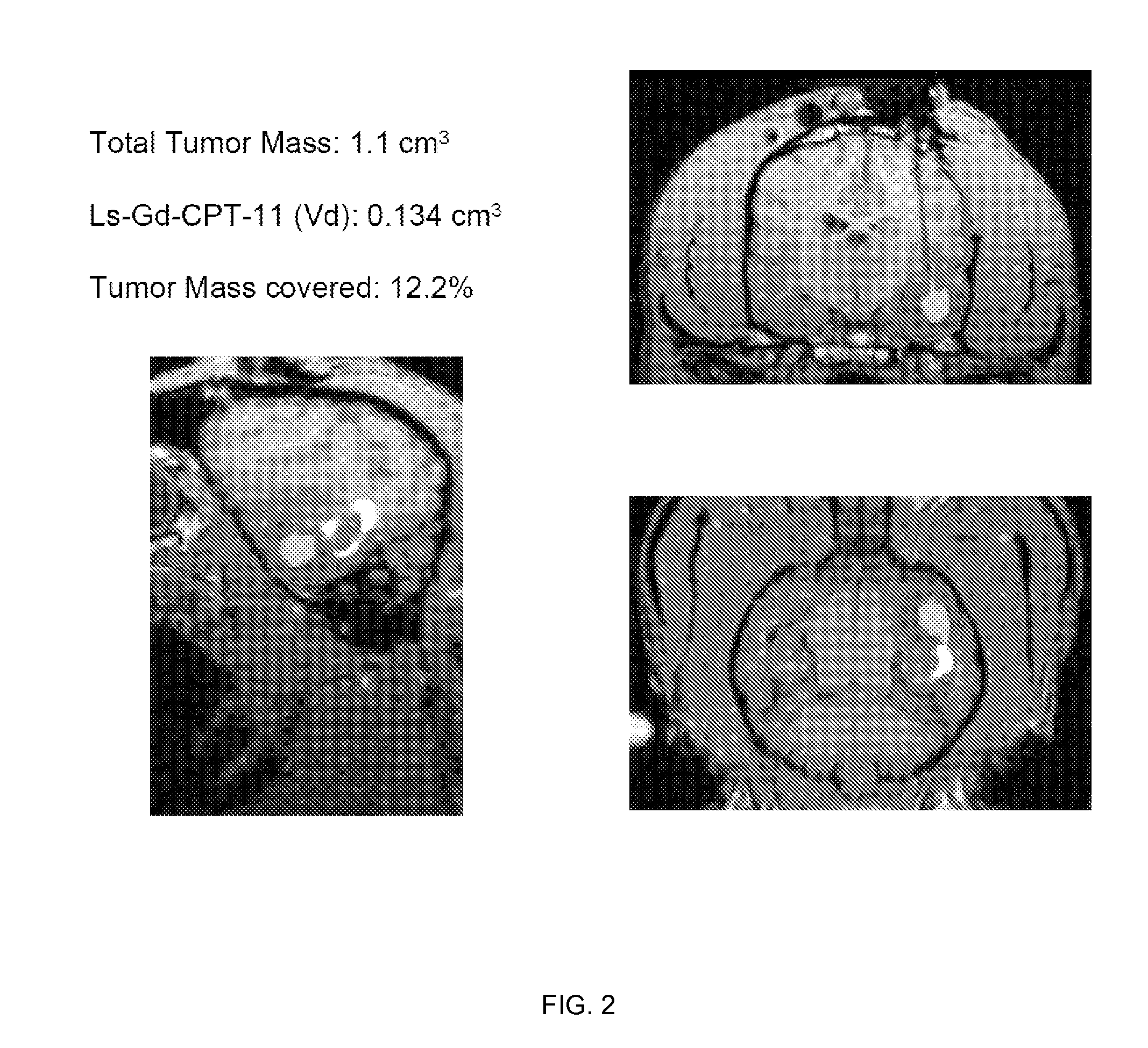 Compositions and methods for convection enhanced delivery of high molecular weight neurotherapeutics