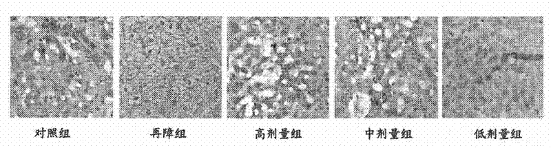 Application of nutritional composition in preparation of medicine for promoting proliferation of liver stem cells