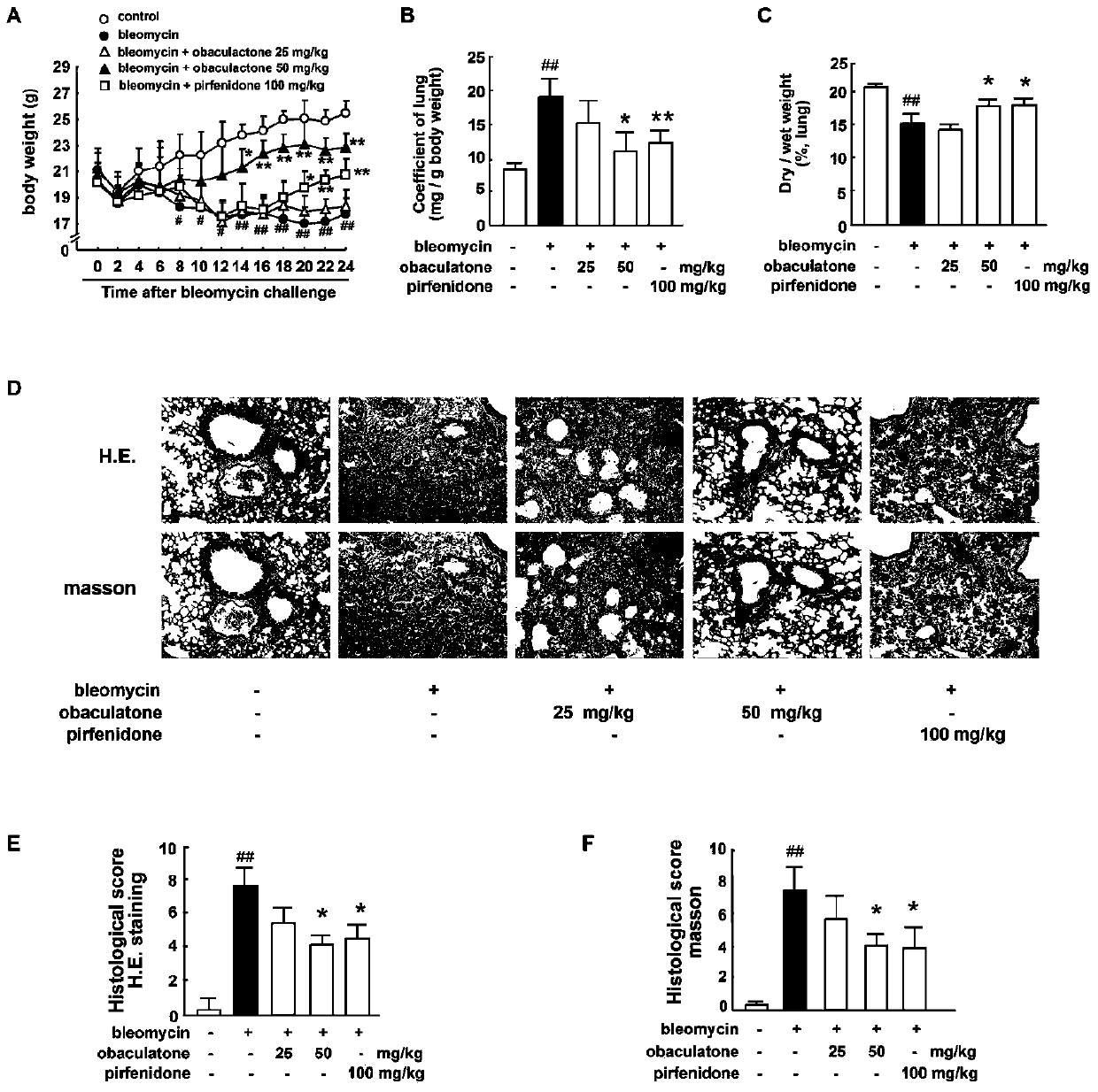 Application of phellodendron lactone in preparation of medicines for treating pulmonary fibrosis, chronic pneumonia and chronic respiratory diseases and medicines thereof