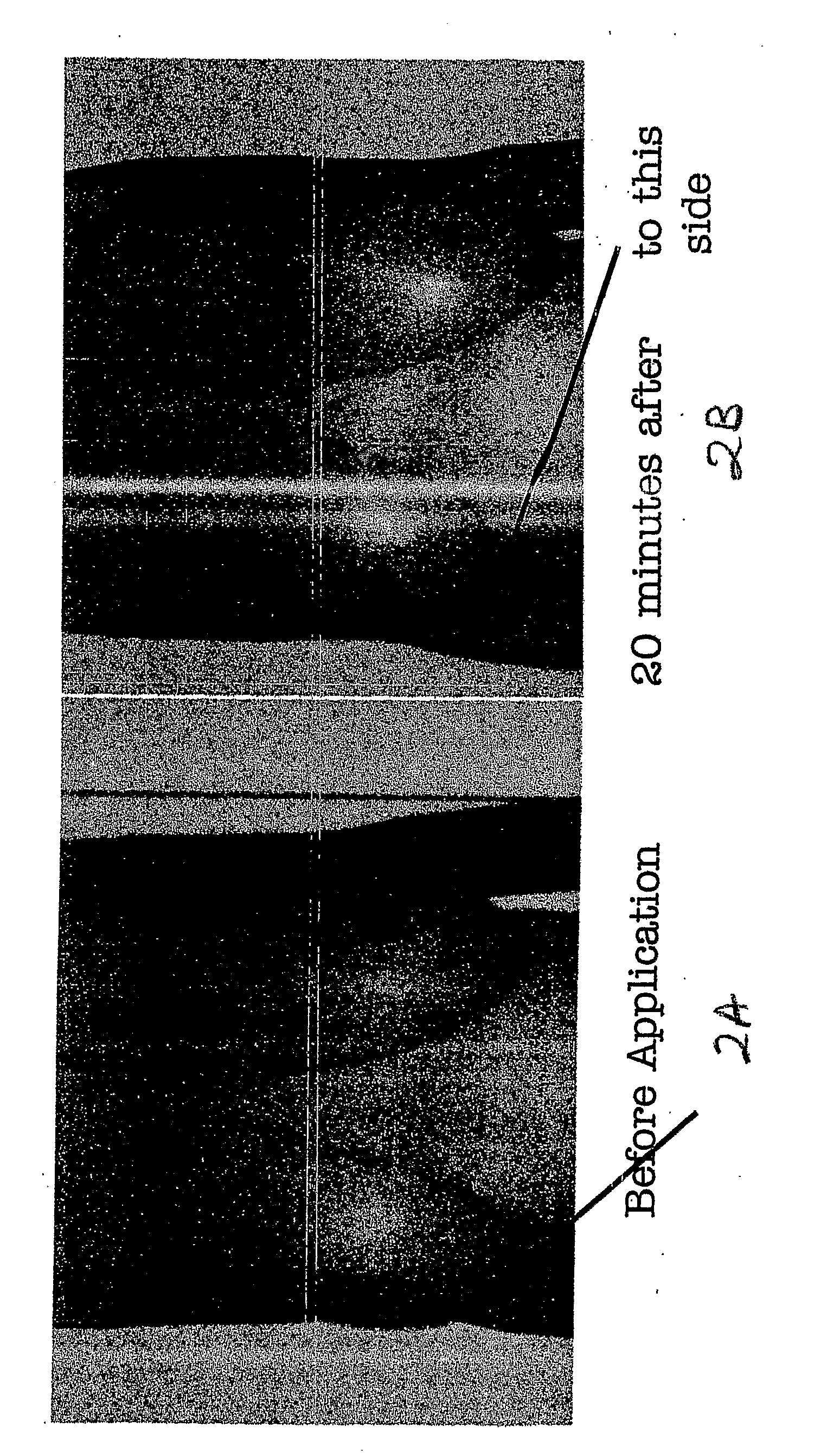 Topical Delivery of a Nitric Oxide Donor to Improve and Skin Appearance