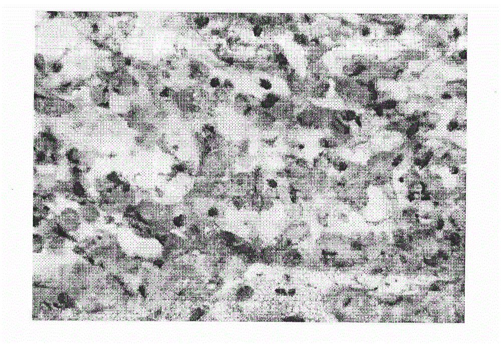 Cardiac muscle tissue engineering product and its preparation method and use