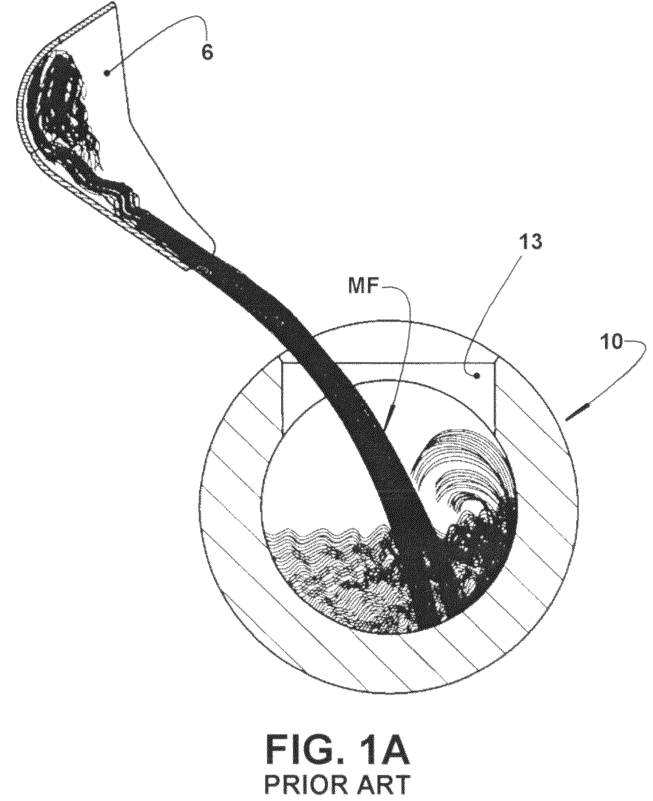 Injection chamber for a metal injection machine