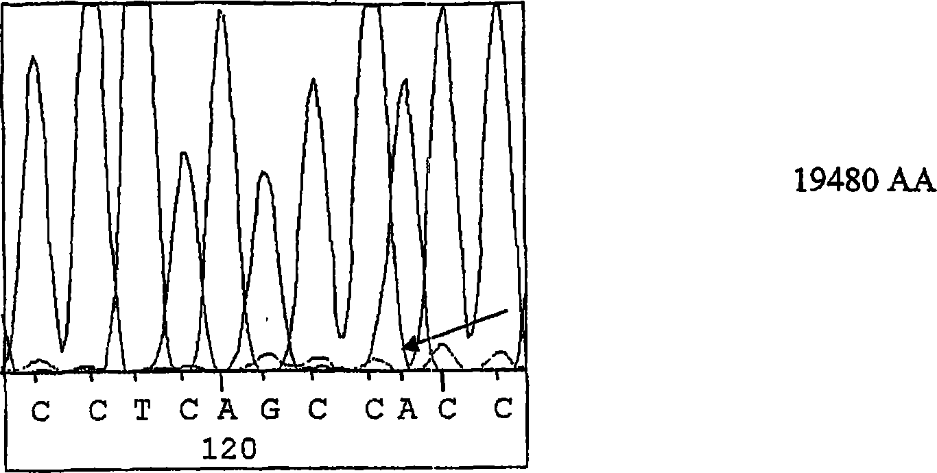 Method of detecting predisposition to high altitude pulmonary edema