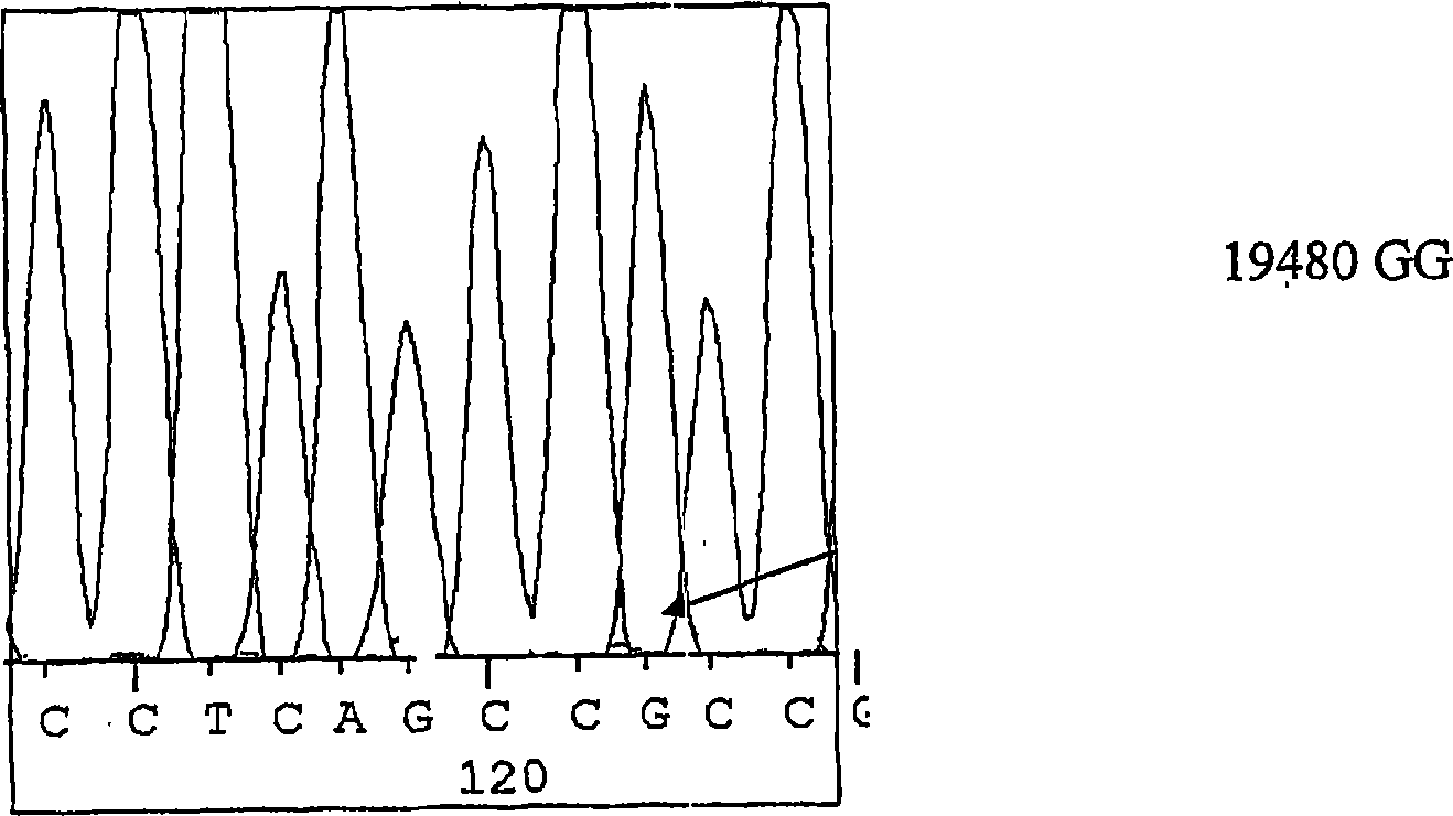 Method of detecting predisposition to high altitude pulmonary edema