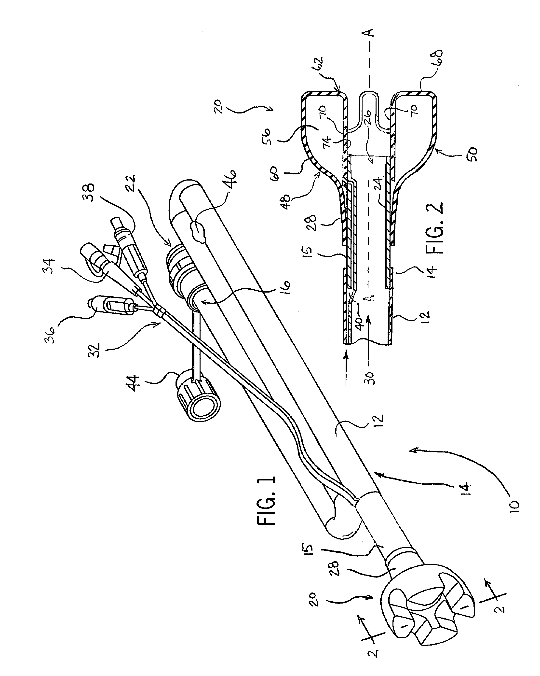 Retention Cuff for Bowel Management System