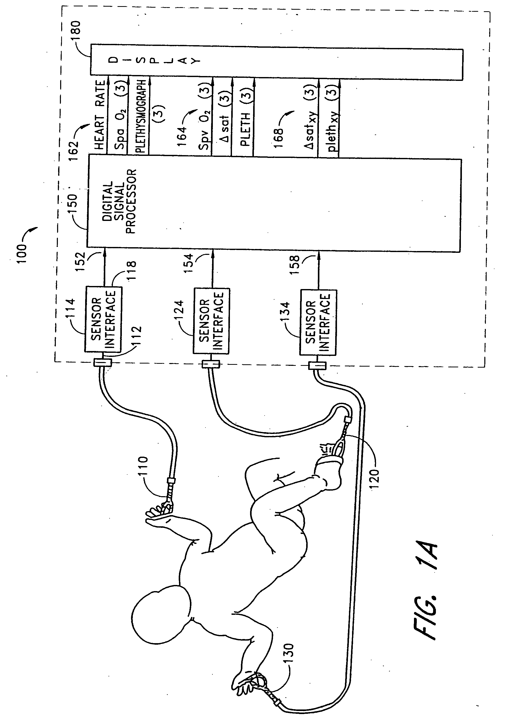 Stereo pulse oximeter