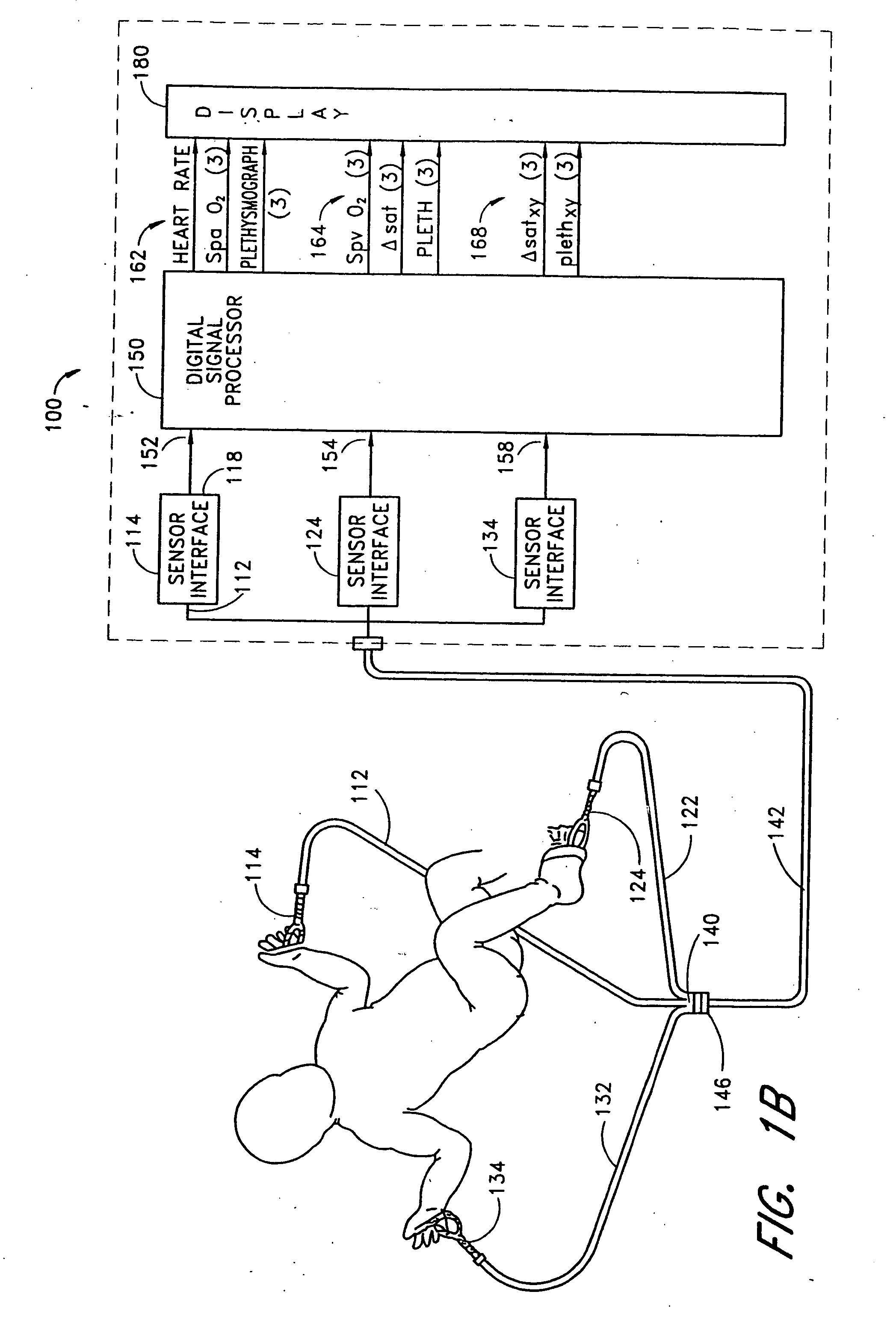 Stereo pulse oximeter