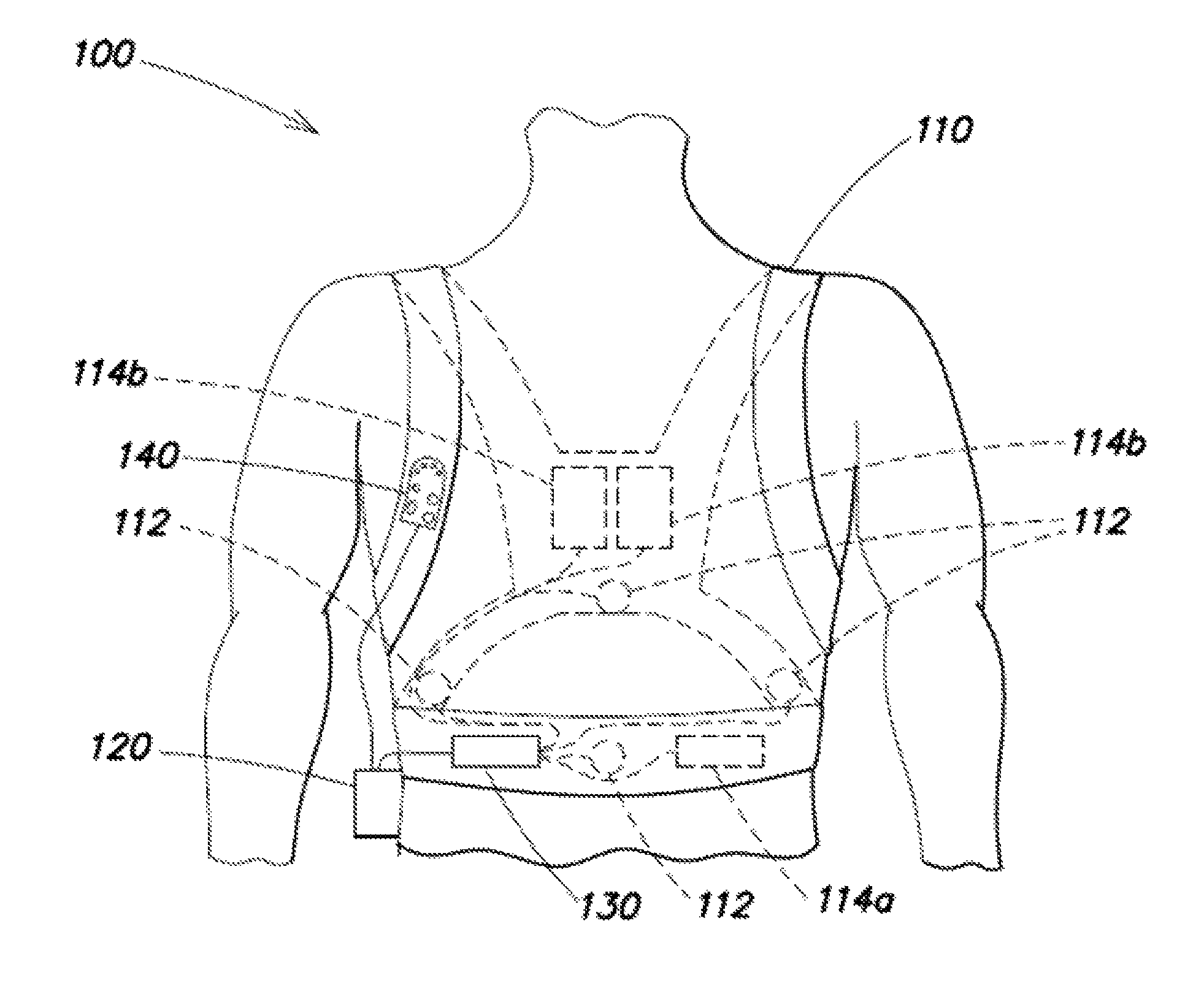 Method of detecting signal clipping in a wearable ambulatory medical device