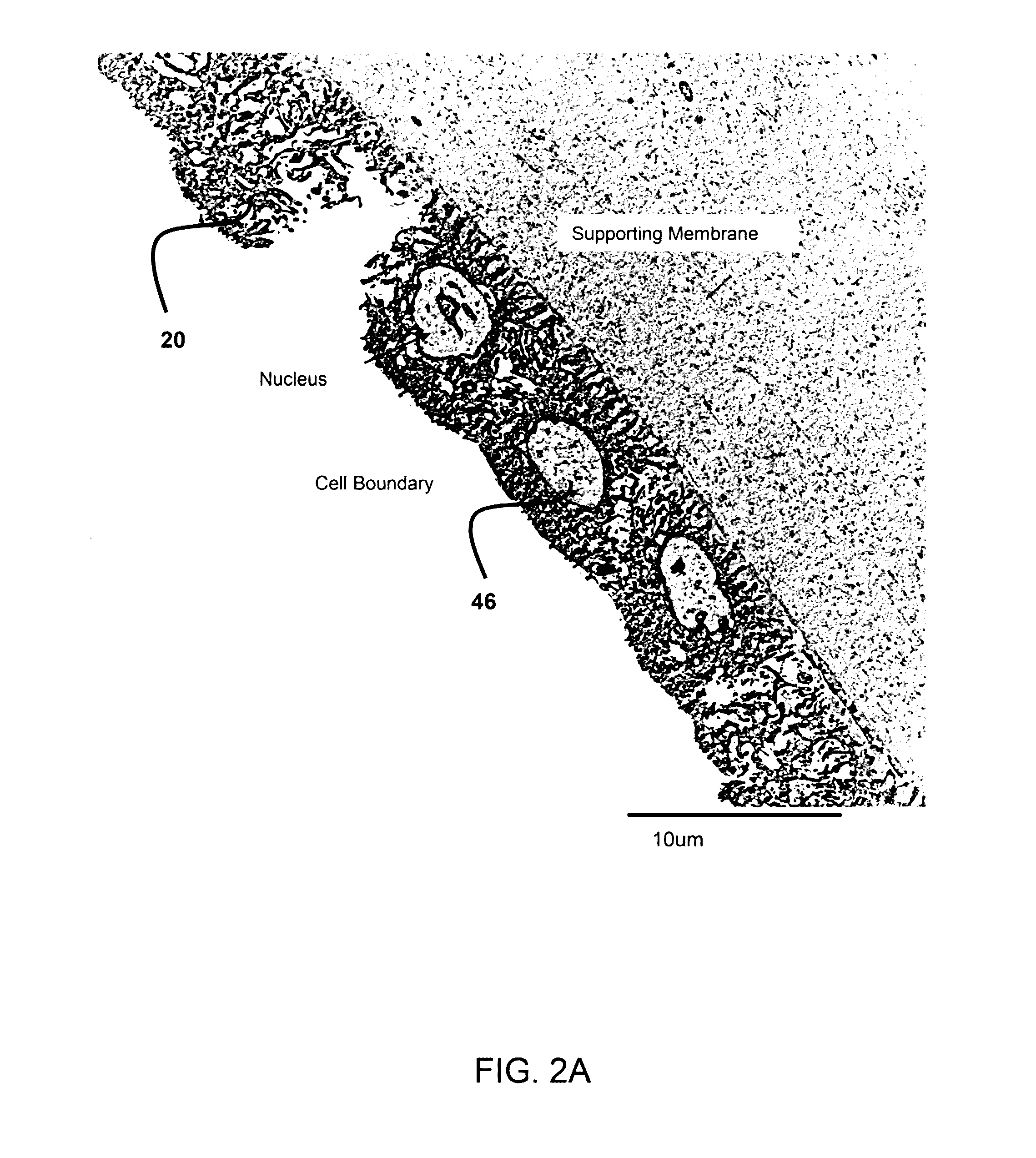 Amnion derived therapeutic compositions and methods of use