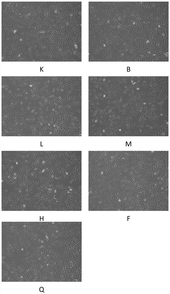 A kind of traditional Chinese medicine composition and its preparation method and application